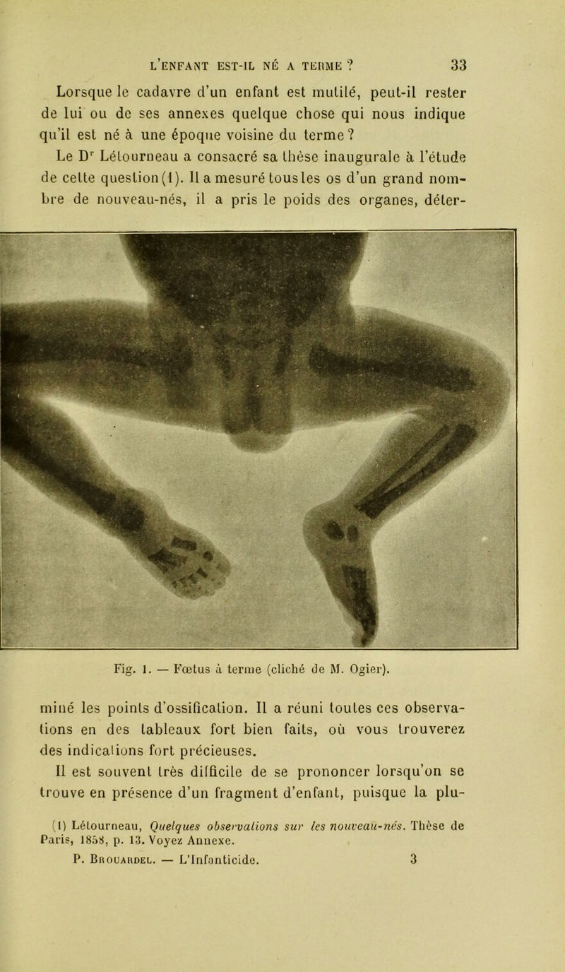 Lorsque le cadavre d’un enfant est mutilé, peut-il rester de lui ou de ses annexes quelque chose qui nous indique qu’il est né à une époque voisine du terme ? Le D’’ Lélourneau a consacré sa thèse inaugurale à l’étude de cette question (1). Il a mesuré tous les os d’un grand nom- bre de nouveau-nés, il a pris le poids des organes, déter- Fig. 1. — Fœtus à terme (cliché de M. Ogier). miné les points d’ossification. Il a réuni toutes ces observa- tions en des tableaux fort bien faits, où vous trouverez des indications fort précieuses. Il est souvent très difficile de se prononcer lorsqu’on se trouve en présence d’un fragment d’enfant, puisque la plu- (I) Lélourneau, Quelques observations sur les nouveau-nés. Thèse de Paris, 1858, p. 13. Voyez Annexe. P. Brouakdel. — L’Infanticide. 3