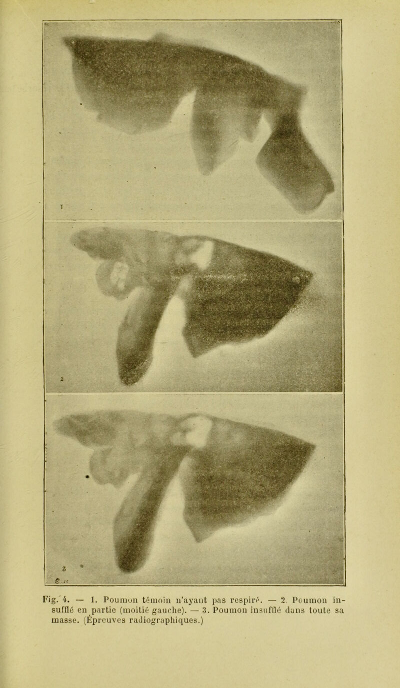 Fig.'4. — 1. Pounj«jii témoin u’ayaiit pas respiré. — 2. Poumon in- sufflé en partie (moitié gauclie). — 3. Poumon insufflé dans toute sa masse. (Épreuves radiographiques.)