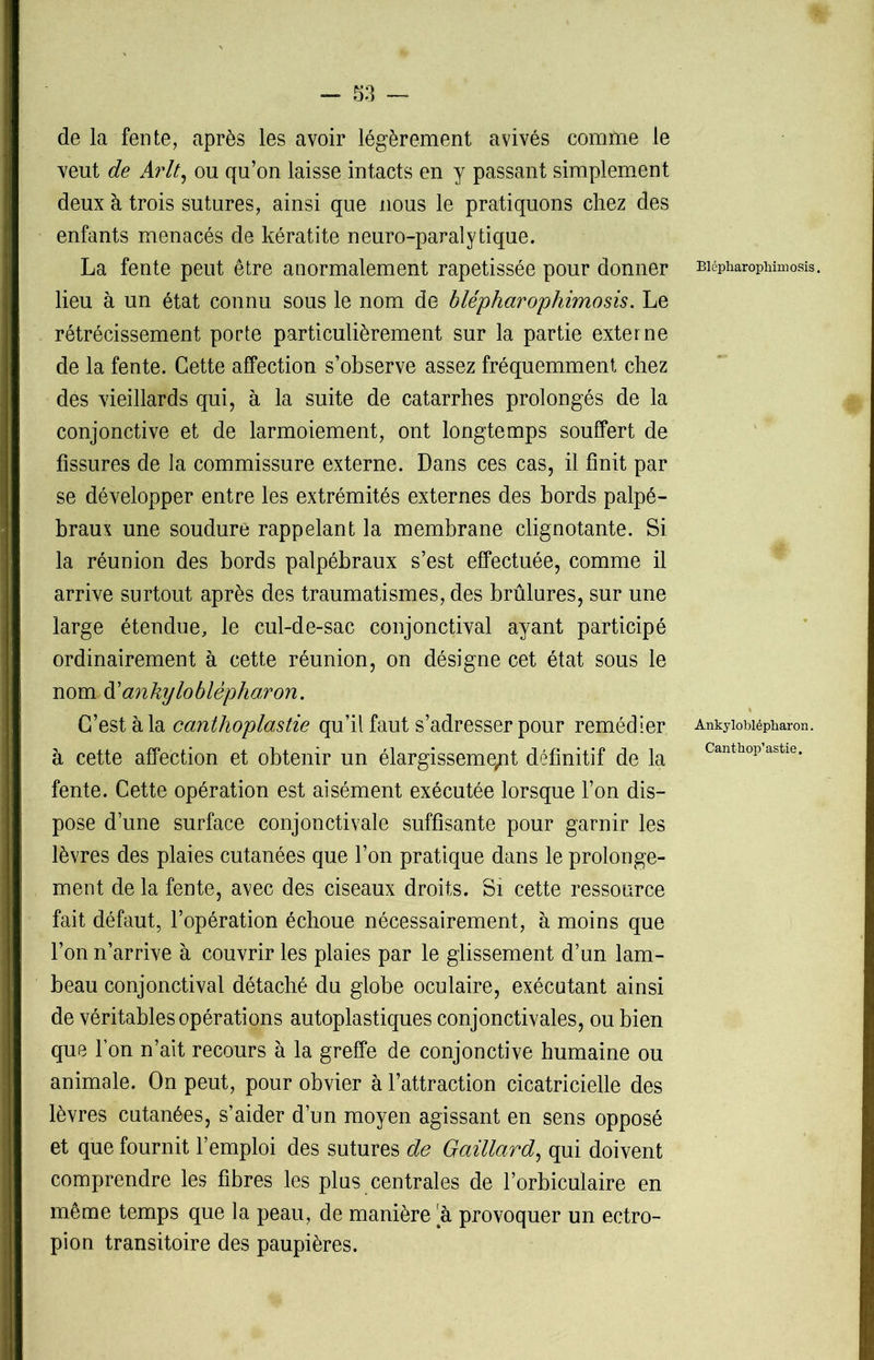 de la fente, après les avoir légèrement avivés comme le veut de Arlt, ou qu’on laisse intacts en y passant simplement deux à trois sutures, ainsi que nous le pratiquons chez des enfants menacés de kératite neuro-paralytique. La fente peut être anormalement rapetissée pour donner Biépharophimosis. lieu à un état connu sous le nom de biépharophimosis. Le rétrécissement porte particulièrement sur la partie externe de la fente. Cette affection s’observe assez fréquemment chez des vieillards qui, à la suite de catarrhes prolongés de la conjonctive et de larmoiement, ont longtemps souffert de fissures de la commissure externe. Dans ces cas, il finit par se développer entre les extrémités externes des bords palpé- braux une soudure rappelant la membrane clignotante. Si la réunion des bords palpébraux s’est effectuée, comme il arrive surtout après des traumatismes, des brûlures, sur une large étendue, le cul-de-sac conjonctival ayant participé ordinairement à cette réunion, on désigne cet état sous le nom d'anhyloblèpharon. C’est à la canthoplastie qu’il faut s’adresser pour remédier Ankyiobiépharon. à cette affection et obtenir un élargissement définitif de la Canthop aske- fente. Cette opération est aisément exécutée lorsque l’on dis- pose dune surface conjonctivale suffisante pour garnir les lèvres des plaies cutanées que l’on pratique dans le prolonge- ment de la fente, avec des ciseaux droits. Si cette ressource fait défaut, l’opération échoue nécessairement, à moins que l’on n’arrive à couvrir les plaies par le glissement d’un lam- beau conjonctival détaché du globe oculaire, exécutant ainsi de véritables opérations autoplastiques conjonctivales, ou bien que l’on n’ait recours à la greffe de conjonctive humaine ou animale. On peut, pour obvier à l’attraction cicatricielle des lèvres cutanées, s’aider d’un moyen agissant en sens opposé et que fournit l’emploi des sutures de Gaillard, qui doivent comprendre les fibres les plus centrales de l’orbiculaire en même temps que la peau, de manière a provoquer un ectro- pion transitoire des paupières.