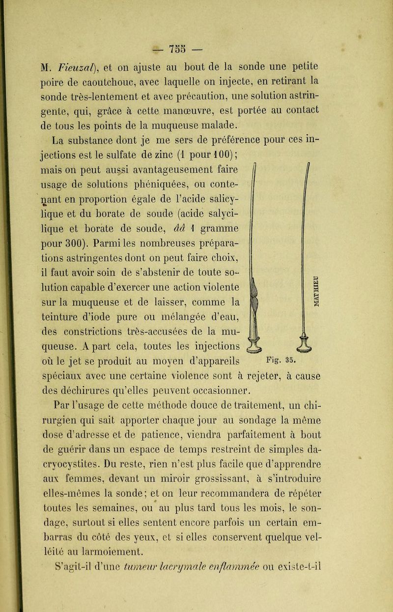 M. Fieuzal), et on ajuste au bout de la sonde une petite poire de caoutchouc, avec laquelle on injecte, en retirant la sonde très-lentement et avec précaution, une solution astrin- gente, qui, grâce à cette manœuvre, est portée au contact de tous les points de la muqueuse malade. La substance dont je me sers de préférence pour ces in- jections est le sulfate de zinc (1 pour 100) ; mais on peut au§si avantageusement faire usage de solutions phéniquées, ou conte- nant en proportion égale de l’acide salicy- lique et du borate de soude (acide salyci- lique et borate de soude, ââ \ gramme pour 300). Parmi les nombreuses prépara- tions astringentes dont on peut faire choix, il faut avoir soin de s’abstenir de toute so- lution capable d’exercer une action violente sur la muqueuse et de laisser, comme la teinture d’iode pure ou mélangée d’eau, des constrictions très-accusées de la mu- queuse. A part cela, toutes les injections où le jet se produit au moyen d’appareils Fis- 33* spéciaux avec une certaine violence sont à rejeter, à cause des déchirures qu’elles peuvent occasionner. Par l’usage de cette méthode douce de traitement, un chi- rurgien qui sait apporter chaque jour au sondage la même dose d’adresse et de patience, viendra parfaitement à bout de guérir dans un espace de temps restreint de simples da- cryocystites. Du reste, rien n’est plus facile que d’apprendre aux femmes, devant un miroir grossissant, à s’introduire elles-mêmes la sonde ; et on leur recommandera de répéter toutes les semaines, ou au plus tard tous les mois, le son- dage, surtout si elles sentent encore parfois un certain em- barras du côté des yeux, et si elles conservent quelque vel- léité au larmoiement. S’agit-il d’une tumeur lacrymale enflammée ou existe-t-il