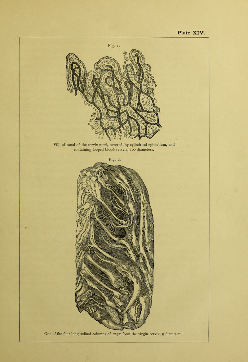 Fig. I. Villi of canal of the cervix uteri, covered by cylindrical epithelium, and containing looped blood-vessels, too diameters. Fig. 2. One of the four longitudinal columns of rugae from the virgin cervix, 9 diameters.