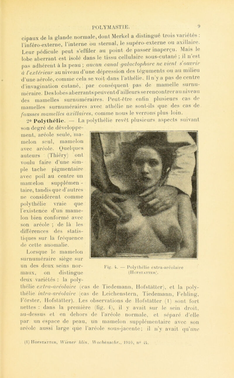 cipaux de la glande normale, dont Merkel a distingué trois variétés : l’inréro-externe, l’interne ou sternal, le supéro-externe ou axillaire. Leur pédicule peut s’elTiler au point de passer mapenju. Mais le lobe aberrant est isolé dans le tissu cellulaire sous-cutané , il ii est pas adhérent à la peau ; aucun canal (jalaclophore ne vient s ouvrir à l'extérieur au niveau d’une dépression des téguments ou au milieu d’une aérole, comme cela se voit dans l atlielie. Il n y a pas de centie d’invagination cutané, par conséquent pas de mamelle surnu- méraire. Des lobes aberrants peuvent d’ailleurs se rencontrer a U niveau des mamelles surnuméraires. Peut-être enlin plusieurs cas de mamelles surnuméraires avec atliélie ne sont-ils (}ue des cas de fausses mamelles axillaires, comme nous le verrons plus loin. •JO Polythélie. — La polytliélie revêt plusieurs aspects suivant son degré de développe- ment, aréole seule, ma- melon seul, mamelon avec aréole. Ouelques auteurs (Thiéry) ont voulu faire d’une sim- ple tache pigmentaire avec poil au centre un mamelon supplémen - taire, tandis que d’autres ne considèrent comme polythélie vraie que l'existence d’un mame- lon bien conformé avec son aréole ; de là les dillerences des statis- tiques sur la fréquence de cette anomalie. Lorsque le mamelon surnuméraire siège sur un des deux seins nor- maux, on distingue deux variétés : la poly- thélie exlra-aréolaire (cas de Tiedemann, 1 lofstàtter), et la l>oly- Ihélie inlra-aréolaire (cas de Leichenstern, Tiedemann, Fehling, Forster, llofsliUter). Les obscrvalions de llofslàttcr (I) sont fort nettes : dans la première (fig. 1), il y avait sur le sein droit, au-dessus et en dehors de l’aré(de normale, et séparé d’elle par un espace de peau, un mamelon supplémentaire avec son aréole aussi large (|uc l’aréole sous-jacente; il n'y avait ([u'une Pülylliclie cxtra-arcolaire (IloKSTATTKlO. ( 1) IIofstatti:i\, Wiener Idin. ochenschr., 1910, no l/,.