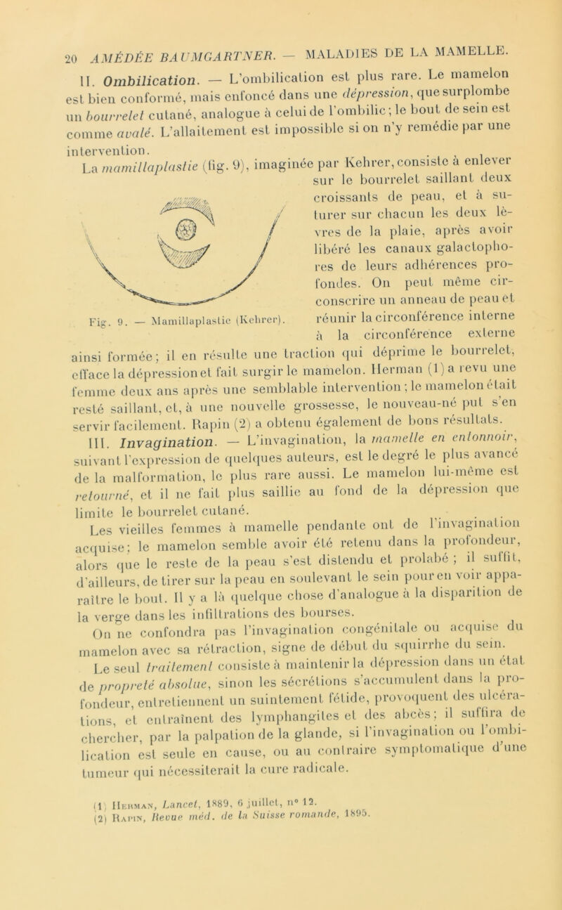 Fig. 9. — MamillaplasUc (Kelirer). IL Ombilication. - L’ombilicalion esl plus rare. Le mamelon est bien conformé, mais enfoncé dans une dépression, que surplombe un bourrelet cutané, analogue à celui de l’ombdic; le bout de sein esl comme avcdé. L’allaitemenl esl impossible si on n’y remédie par une intervenlion. . , La mamillaplaslie ^lig. 9), imaginée par Kelirer, consiste a enlever sur le bourrelet saillant deux croissants de peau, et à su- turer sur chacun les deux lè- vres de la plaie, après avoir libéré les canaux galacloplio- res de leurs adhérences pro- fondes. On peut même cir- conscrire un anneau de peau et réunir la circonférence interne à la circonférence externe ainsi formée; il en résulte une traction ([ui déprime le bourrelet, etface la dépression et fait surgir le mamelon. Herman (l)a revu une femme deux ans après une semldable intervenlion ; le mamelon était resté saillant, et, à une nouvelle grossesse, le nouveau-né jnit s’en servir facilement. Uapin (*2) a obtenu également de bons résultats. 111. Invagination. — L’invagination, la mamelle en entonnoir, suivant l’expression de (piehpies auteurs, est le degré le plus avance de la malformation, le plus rare aussi. Le mamelon lui-même est retourné, et il ne fait plus saillie au fond de la dépression que limite le bourrelet cutané. Les vieilles femmes à mamelle pendante ont de rmvaginatioii acquise; le mamelon semble avoir été retenu dans la profondeur, alors (jue le reste de la peau s’est distendu et prolabé ; il suffit, d'ailleurs, de tirer sur la peau en soulevant le sein pour en voir appa- raître le bout. Il y a là (pielque chose d’analogue à la disparition de la verge dans les infiltrations des bourses. On ne confondra pas l’invagination congénitale ou acipiise du mamelon avec sa rétraction, signe de début du s([uiiTlie du sein. Le seul trailemenl consiste à maintenir la dépression dans un état (\q propreté absolue, sinon les sécrétions s’accumulent dans la [n-o- fondeur, entretiennent un suintement fétide, provoipient des ulcéra- tions, et entraînent des lymphangites et des abcès; il suffira de chercher, par la palpation de la glande, si l’invagination ou l’ombi- lication est seule en cause, ou au conlraire syiufitomatique d’une tumeur <pii mîcessiterait la cure ladicale. /l, IIehman, Liincel, 1^80, 6 jiiillcl, n° 12. (2) Haimn, lteüü(' niéd. de lit Suisse roinnnde, 1895.