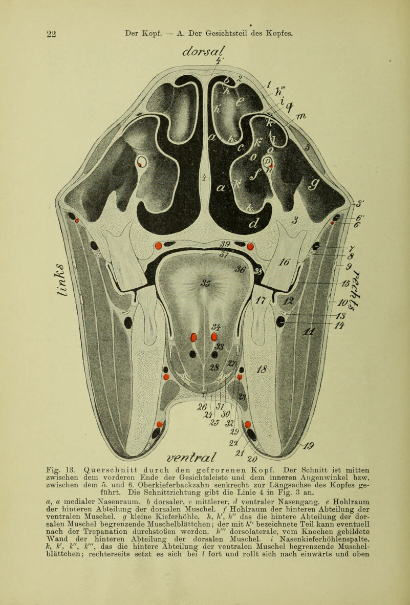 dorsal Fig. 13. Querschnitt durch den gefrorenen Kopf. Der Schnitt ist mitten zwischen dem vorderen Ende der Gesichtsleiste und dem inneren Augenwinkel bzw. zwischen dem 5. und 6. Oberkieferbackzahn senkrecht zur Längsachse des Kopfes ge- führt. Die Schnittrichtung gibt die Linie 4 in Fig. 3 an. a, a medialer Nasenraum. h dorsaler, c mittlerer, ä ventraler Nasengang, e Hohlraum der hinteren Abteilung der dorsalen Muschel, f Hohlraum der hinteren Abteilung der ventralen Muschel, g kleine Kieferhöhle. 7i, h\ h das die hintere Abteilung der dor- salen Muschel begrenzende Muschelblättchen; der mit h bezeichnete Teil kann eventuell nach der Trepanation durchstoßen werden, h' dorsolaterale, vom Knochen gebildete Wand der hinteren Abteilung der dorsalen Muschel, i Nasenkieferhöhlenspalte. k, k\ A, k'”, das die hintere Abteilung der ventralen Muschel begrenzende Muschel- blättchen; rechterseits setzt es sich bei l fort und rollt sich nach einwärts und oben