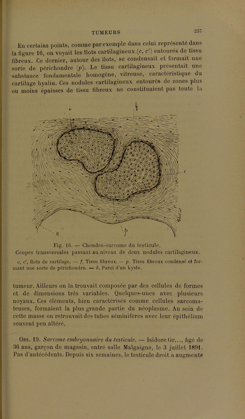 En certains points, comme par exemple dans celui représenté dans la figure 16, on voyait les Ilots cartilagineux (c, c ) entourés de tissu fibreux. Ce dernier, autour des îlots, se condensait et formait une sorte de périchondre (p). Le tissu cartilagineux piésentait une substance fondamentale homogène, vitreuse, caractéristique du cartilage hyalin. Ces nodules cartilagineux entourés de zones plus ou moins épaisses de tissu fibreux ne constituaient pas toute la Fig. 16. — Chondro-sarcome du testicule. Coupes transversales passant au niveau de deux nodules cartilagineux. c, c', Ilots de cartilage. — f, Tissu fibreux. — p. Tissu fibreux condensé et for- mant une sorte de périchondre. — k, Paroi d’un kyste. tumeur. Ailleurs on la trouvait composée par des cellules de formes et de dimensions très variables. Quelques-unes avec plusieurs noyaux. Ces éléments, bien caractérisés comme cellules sarcoma- teuses, formaient la plus grande partie du néoplasme. Au sein de cette masse on retrouvait des tubes séminifères avec leur épithélium souvent peu altéré. Obs. 19. Sarcome embryonnaire du testicule. — Isidore Gr..., âgé de 36 ans, garçon de magasin, entré salle Malgaigne, le 3 juillet 1891. Pas d'antécédents. Depuis six semaines, le testicule droit a augmenté