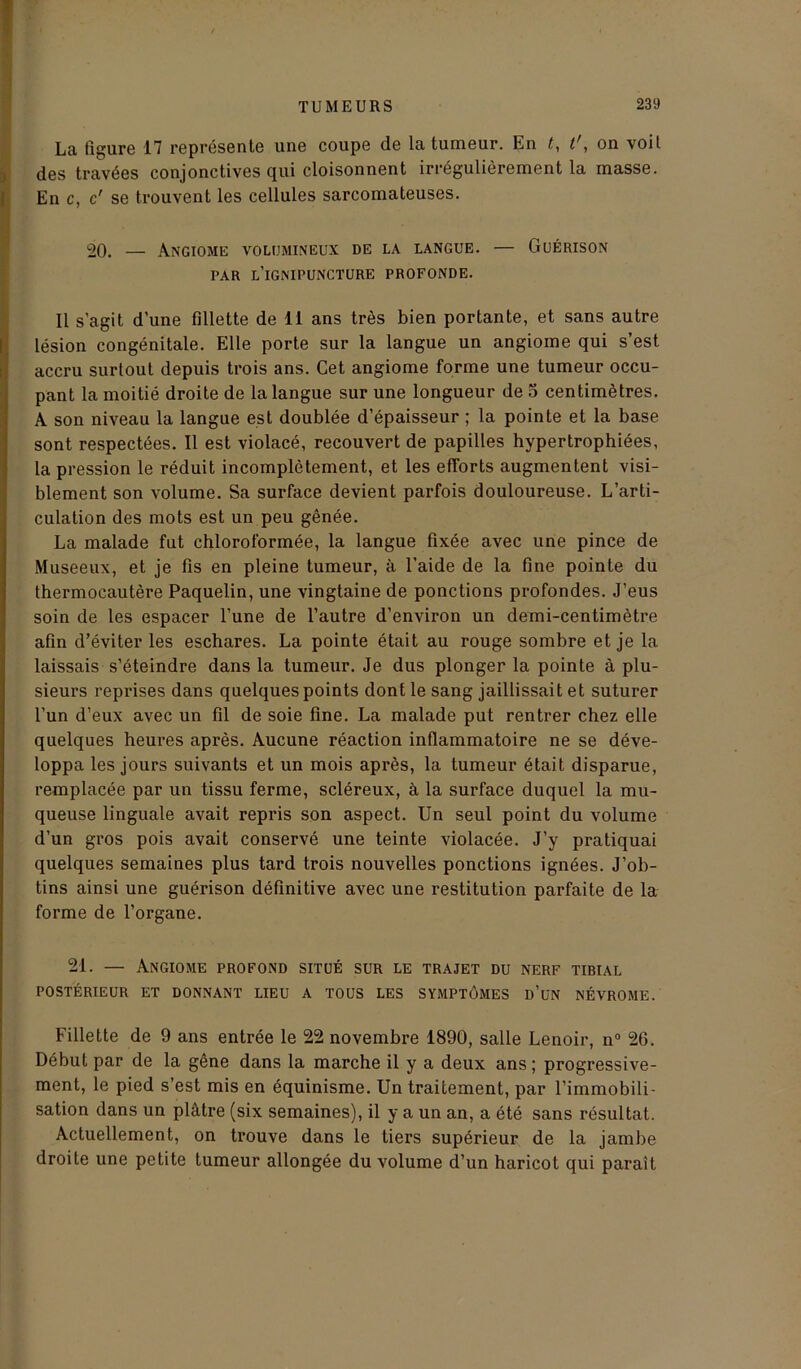 La figure 17 représente une coupe de la tumeur. En t, t', on voit des travées conjonctives qui cloisonnent irrégulièrement la masse. En c, c' se trouvent les cellules sarcomateuses. 20. — Angiome volumineux de la langue. — Guérison PAR L’iGNIPUNCTURE PROFONDE. Il s'agit d’une fillette de 11 ans très bien portante, et sans autre lésion congénitale. Elle porte sur la langue un angiome qui s’est accru surtout depuis trois ans. Cet angiome forme une tumeur occu- pant la moitié droite de la langue sur une longueur de o centimètres. A son niveau la langue est doublée d’épaisseur ; la pointe et la base sont respectées. Il est violacé, recouvert de papilles hypertrophiées, la pression le réduit incomplètement, et les efforts augmentent visi- blement son volume. Sa surface devient parfois douloureuse. L’arti- culation des mots est un peu gênée. La malade fut chloroformée, la langue fixée avec une pince de Museeux, et je fis en pleine tumeur, à l'aide de la fine pointe du thermocautère Paquelin, une vingtaine de ponctions profondes. J’eus soin de les espacer l’une de l’autre d’environ un demi-centimètre afin d’éviter les eschares. La pointe était au rouge sombre et je la laissais s’éteindre dans la tumeur. Je dus plonger la pointe à plu- sieurs reprises dans quelques points dont le sang jaillissait et suturer l’un d’eux avec un fil de soie fine. La malade put rentrer chez elle quelques heures après. Aucune réaction inflammatoire ne se déve- loppa les jours suivants et un mois après, la tumeur était disparue, remplacée par un tissu ferme, scléreux, à la surface duquel la mu- queuse linguale avait repris son aspect. Un seul point du volume d’un gros pois avait conservé une teinte violacée. J’y pratiquai quelques semaines plus tard trois nouvelles ponctions ignées. J’ob- tins ainsi une guérison définitive avec une restitution parfaite de la forme de l’organe. 21. — Angiome profond situé sur le trajet du nerf tibial POSTÉRIEUR ET DONNANT LIEU A TOUS LES SYMPTÔMES d’üN NÉVROME. Fillette de 9 ans entrée le 22 novembre 1890, salle Lenoir, n° 26. Début par de la gêne dans la marche il y a deux ans; progressive- ment, le pied s’est mis en équinisme. Un traitement, par l’immobili- sation dans un plâtre (six semaines), il y a un an, a été sans résultat. Actuellement, on trouve dans le tiers supérieur de la jambe droite une petite tumeur allongée du volume d’un haricot qui parait