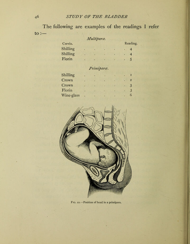 The following are examples of the readings I refer to :— Cervix. Shilling Shilling Florin Shilling Crown Crown Florin Wine-glass Multipart. Reading. . 4 . 4 . 5 Primipcirce. 2 • 3 • 3 . 6