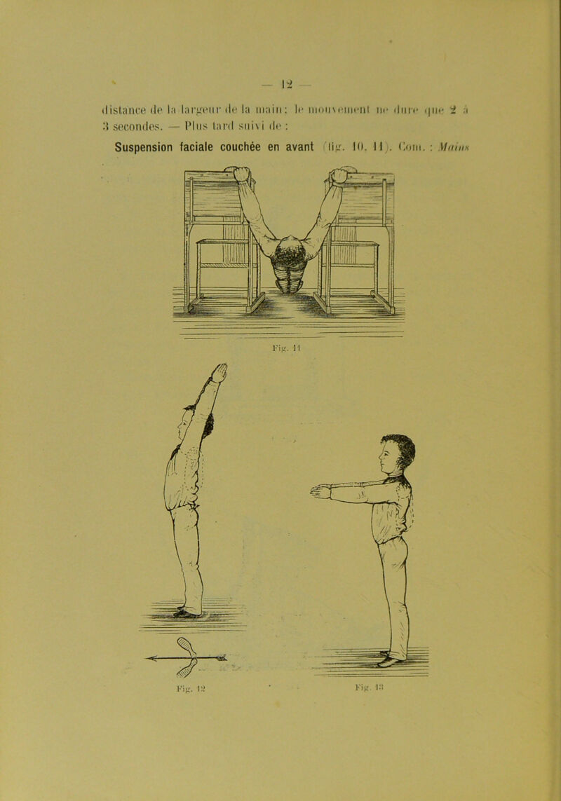 hi distance de la larjreur de la ma i n: :{ secondes. — Plus tard sui\i de : le niomemenl ne dure <|iie Suspension faciale couchée en avant i'li<r. 10. II;. (lom. : Mainx 1’i'C. II