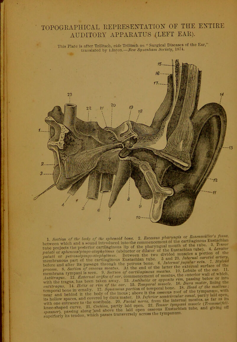 TOPOGRAPHICAL REPRESENTATION OF THE ENTIRE AUDITORY APPARATUS (LEFT EAR). This Plate is after TrOltscta, vide Triiltsch on “ Surgical Diseases of the Ear, translated by hinton.—New Syaenham Society, 1874. 1. Section of the body of the sphenoid hone. 2. Recessus between which and a sound introduced into the commencement Of t >e (^ilaginous h ™cm tube projects the posterior cartilaginous lip of the pharyngeal nmnth^ of the tube. 6.J^nsor nutali or sphcnosalpingo-staphuliiius (abductor or dilator of the Eustachian )• , Between the two fri; cd1 mtwcUw a pm* ^ membranous part of the cartilaginous Eustachian tube. 6 am1 23. ™ - s„,!ei,l before and after its passage thiough the petrous bone„ 'Ur c -xto nl surfacc of the process. 8. Section of osseous meatus. At the end of the latter the extort ,, membrane tympanl is seen. it. Section of cartilaginous meatus 10. -« * • intUraaue 12 External orifice of, or, commencement of meatus the anterior na I of t inc • w tl tlu- agus. has been taken away. 13. Antihelix or opposite X antitragus. 14. Helix or rim of tin ear. 15. Temporal mwe/e. M. . with one entrance to 'he vestibule. 20. facial net e. tmnnani muscle (Ti-ommelfetl- SSMSTii™®tSt!“' 5- superiorly its tendon, which passes transversely across the tympanum.