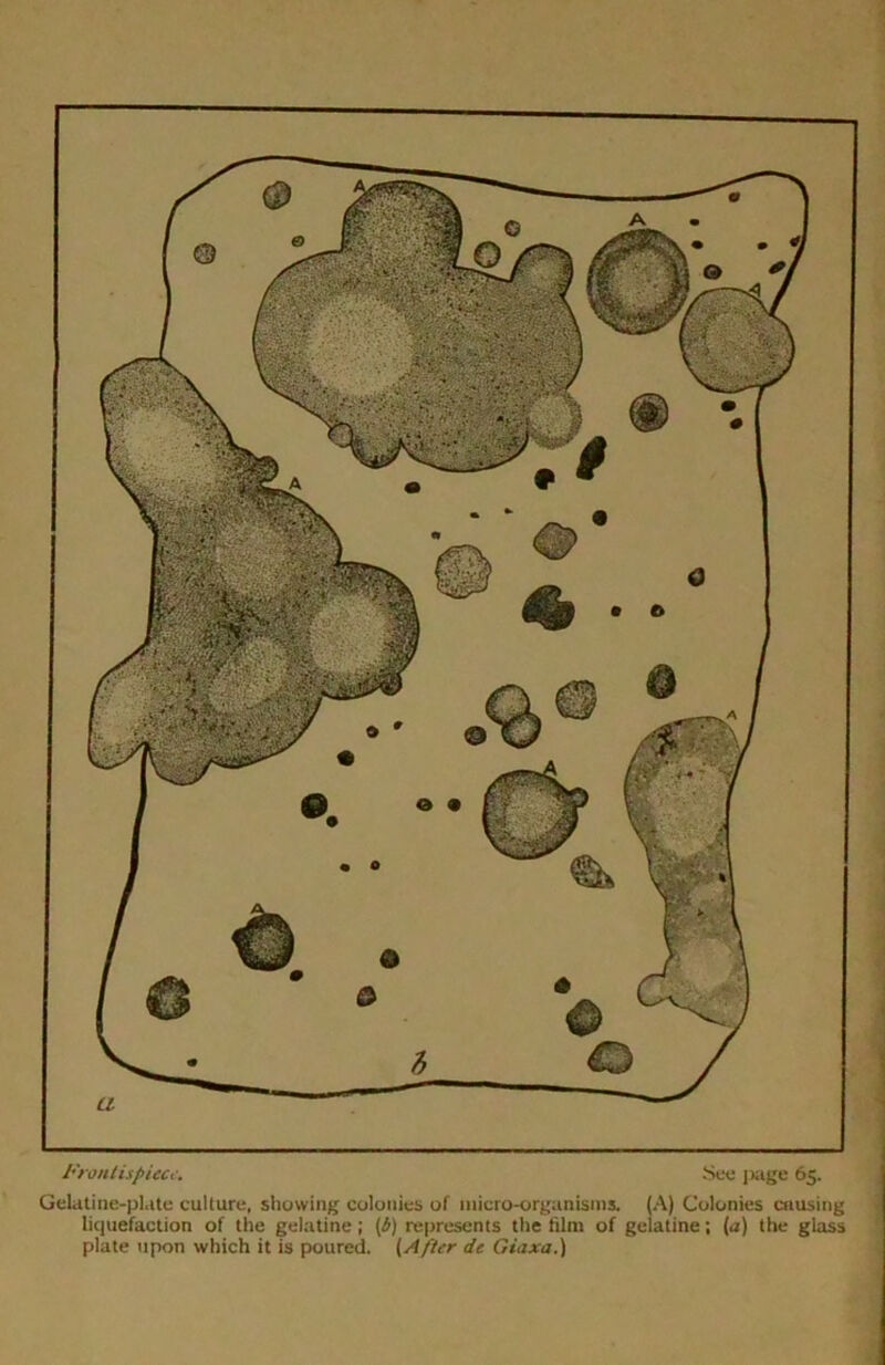 Frontispiece. See page 65. Gelatine-plate culture, showing colonies of micro-organisms. (A) Colonies enusing liquefaction of the gelatine ; (b) represents the film of gelatine; (a) the glass plate upon which it is poured. (After de Giaxa.)