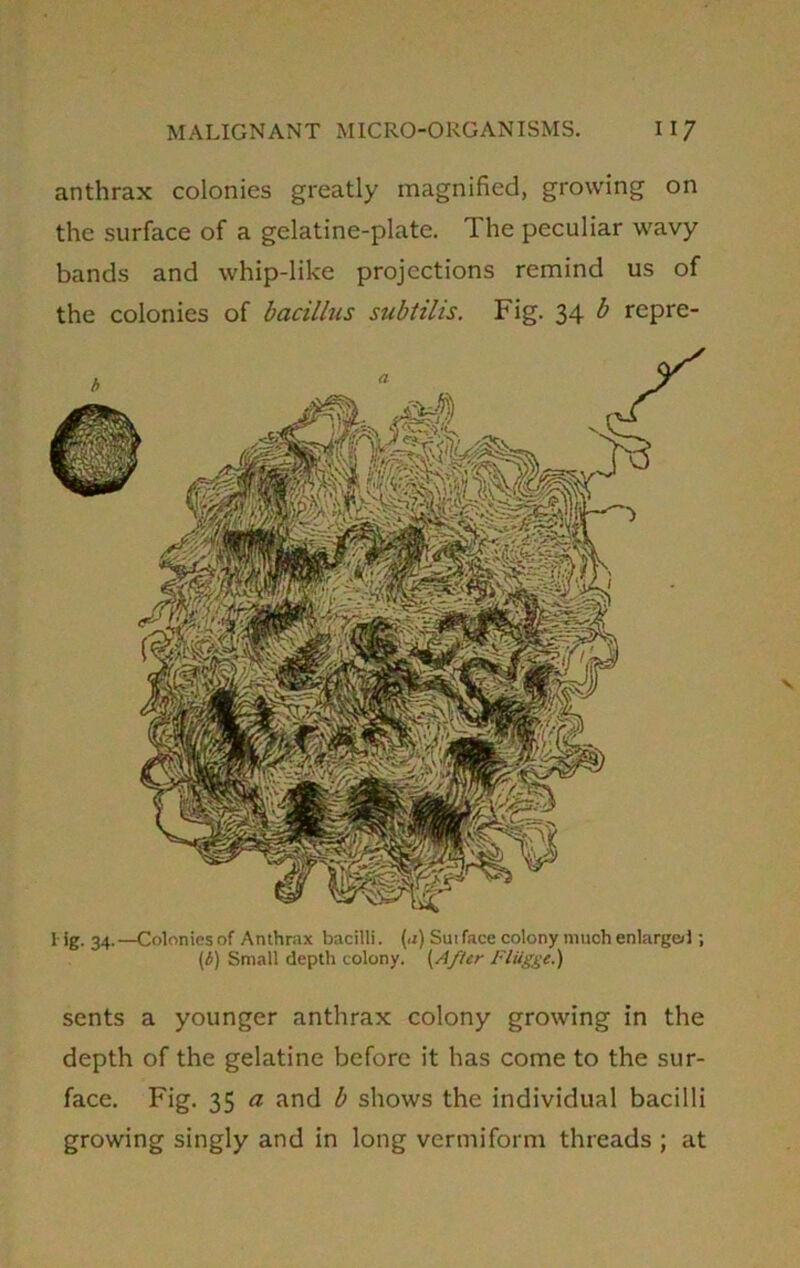 anthrax colonies greatly magnified, growing on the surface of a gelatine-plate. 1 he peculiar wavy bands and whip-like projections remind us of the colonies of bacillus subtil is. Fig. 34 ^ repre- I ig. 34.—Colonies of Anthrax bacilli. (a) Sut face colony much enlarged ; (l) Small depth colony. (After Fltigge.) sents a younger anthrax colony growing in the depth of the gelatine before it has come to the sur- face. Fig. 35 a and b shows the individual bacilli growing singly and in long vermiform threads ; at