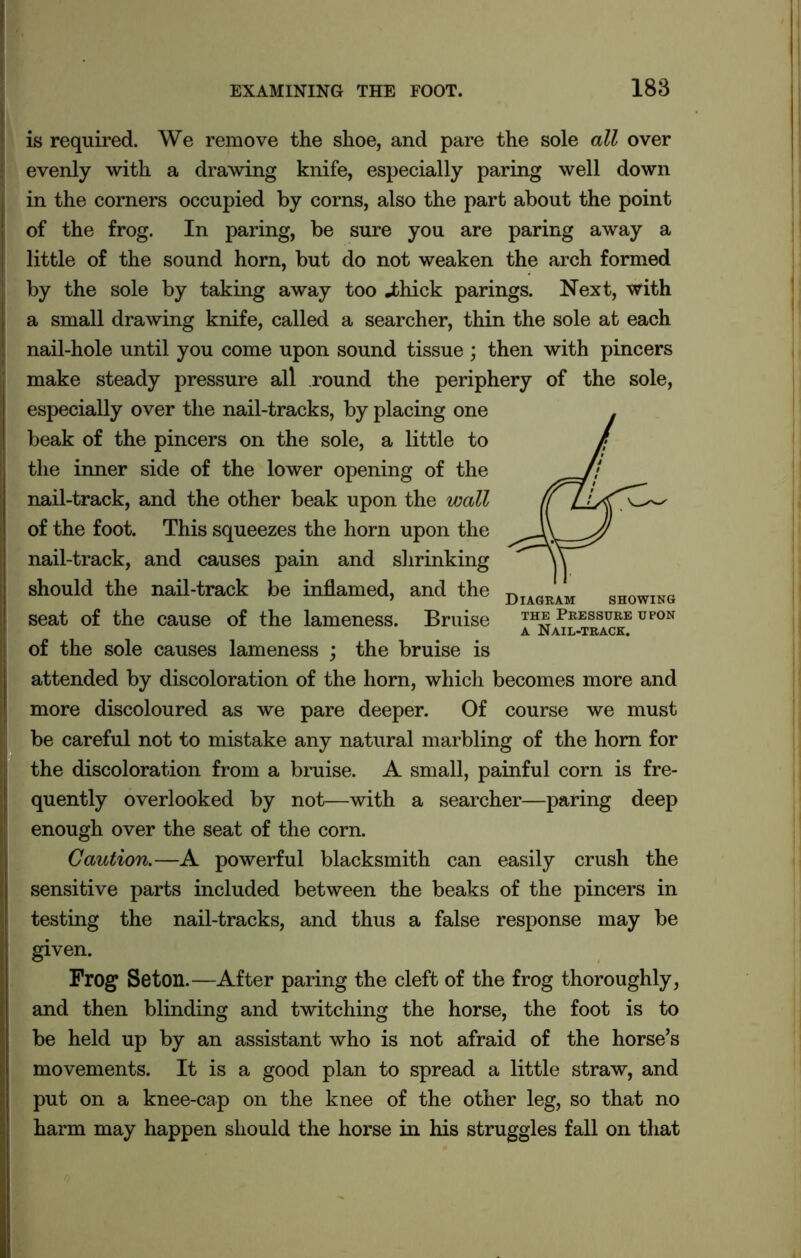 is required. We remove the shoe, and pare the sole all over evenly with a drawing knife, especially paring well down in the corners occupied by corns, also the part about the point of the frog. In paring, be sure you are paring away a little of the sound horn, but do not weaken the arch formed by the sole by taking away too .thick parings. Next, with a small drawing knife, called a searcher, thin the sole at each nail-hole until you come upon sound tissue ; then with pincers make steady pressure all round the periphery of the sole, especially over the nail-tracks, by placing one beak of the pincers on the sole, a little to the inner side of the lower opening of the nail-track, and the other beak upon the wall of the foot. This squeezes the horn upon the nail-track, and causes pain and shrinking should the nail-track be inflamed, and the seat of the cause of the lameness. Bruise the pressure upon a Nail-track. of the sole causes lameness ; the bruise is attended by discoloration of the horn, which becomes more and more discoloured as we pare deeper. Of course we must be careful not to mistake any natural marbling of the horn for the discoloration from a bruise. A small, painful corn is fre- quently overlooked by not—with a searcher—paring deep enough over the seat of the corn. Caution.—A powerful blacksmith can easily crush the sensitive parts included between the beaks of the pincers in testing the nail-tracks, and thus a false response may be given. Frog Seton.—After paring the cleft of the frog thoroughly, and then blinding and twitching the horse, the foot is to be held up by an assistant who is not afraid of the horse’s movements. It is a good plan to spread a little straw, and put on a knee-cap on the knee of the other leg, so that no harm may happen should the horse in his struggles fall on that