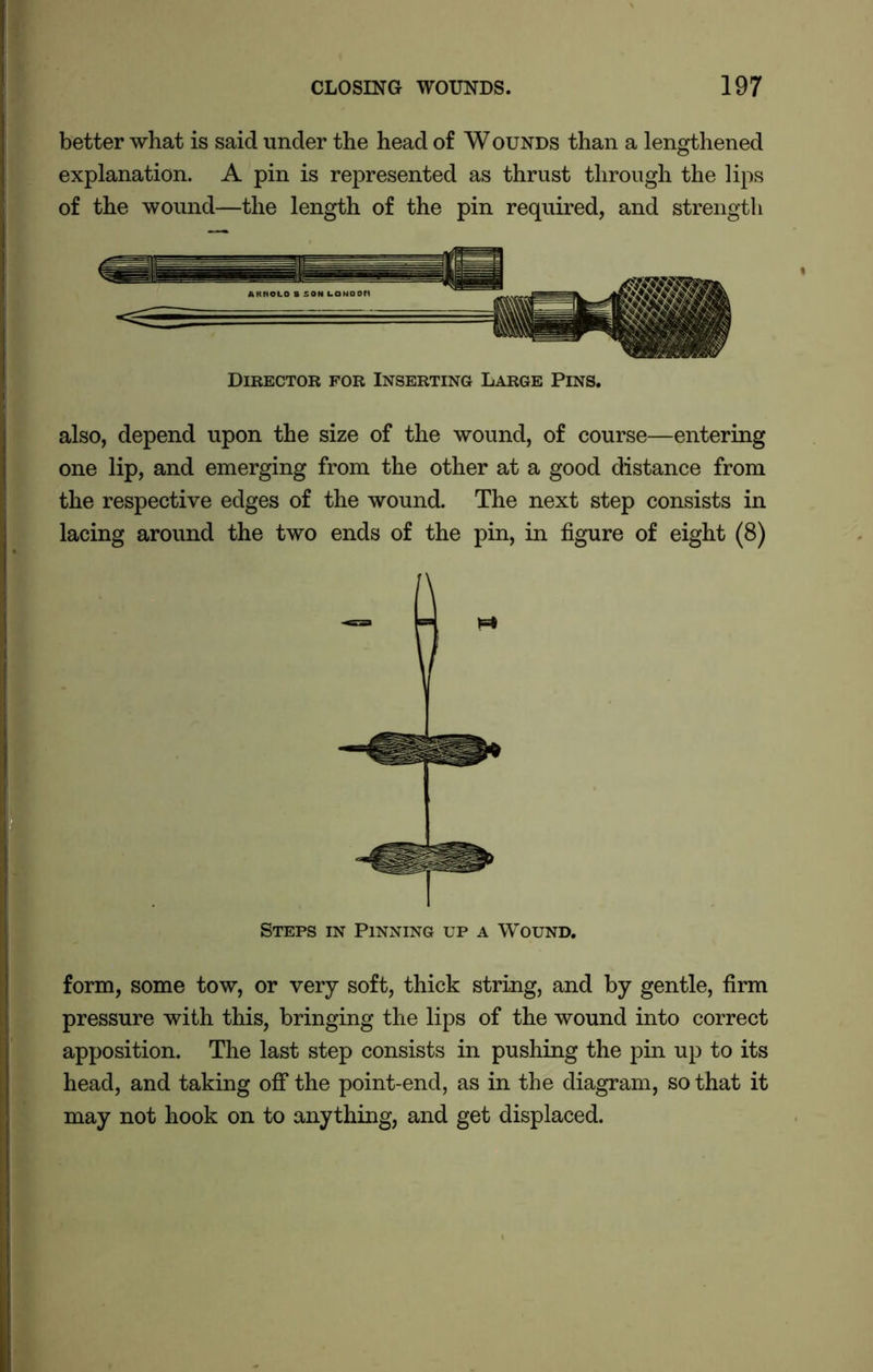 better what is said under the head of Wounds than a lengthened explanation. A pin is represented as thrust through the lips of the wound—the length of the pin required, and strength Director for Inserting Large Pins. also, depend upon the size of the wound, of course—entering one lip, and emerging from the other at a good distance from the respective edges of the wound. The next step consists in lacing around the two ends of the pin, in figure of eight (8) Steps in Pinning up a Wound. form, some tow, or very soft, thick string, and by gentle, firm pressure with this, bringing the lips of the wound into correct apposition. The last step consists in pushing the pin up to its head, and taking off the point-end, as in the diagram, so that it may not hook on to anything, and get displaced.