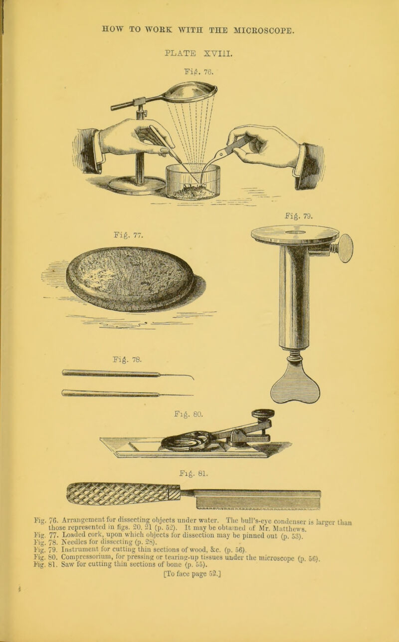 PLATE XVIII. Eii5. 76. Pig. 79. Fig. 70. Arrangement fur dissecting olijects under water. The Imll’s-eyc condenser is laro-cr than those represented in figs. 20. 21 (p. 52). It may he obtained of Mr. Matthews. ° Fig. 77. Loaded cork, upon vvhicli objects for dissection may be pinned out (p. 53). Fig. 78. Needles for dissecting (p. 2s). Fig. 79. Instrument for cutting thin sections of wood, &c. (p. 56). Fig. 80. Compressorium, for pressing or tearing-up tissues under tlie microscope (p. 56) Fig. 81. Saw for cutting thin sections of bone (p. 55).