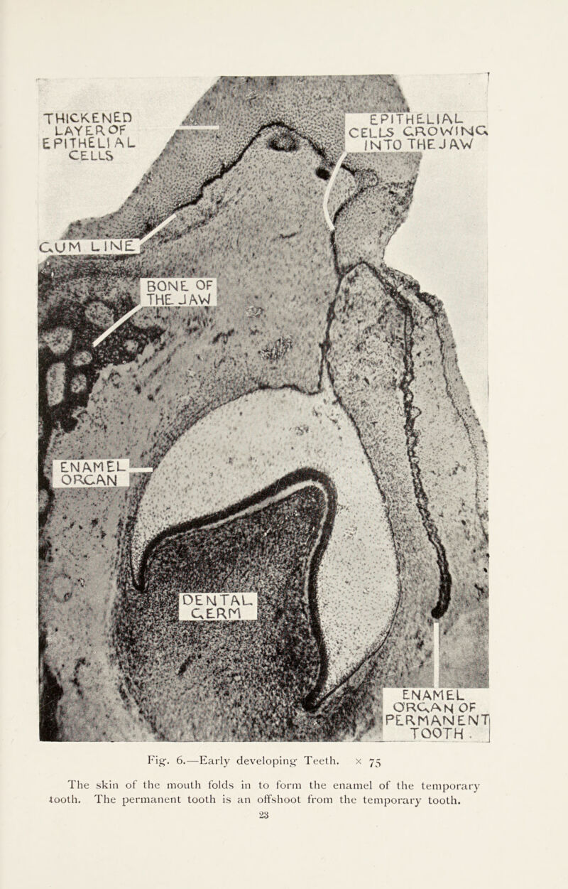 ' BONE. OF THE. J AW ENAMEL ORGAN DENTAL GERM thickened LAYEROF EPITHELI AL CELLS . r % v *. '■*> *4 kV-*”•* «*•, >y*v* * .'•-*.** * . EPITHLLI/NL - :CELLS CROWING • :*jggINTO THEJ AV 48hM. a<iv •» - - ■. .. *.i Jp>*- •' *■ • •’•Wr. CsUM LINE jT JMIK? : .Y-S.il *r * >t Kff ,, K L N A J ORL/ ■Bplrm; Fig-. 6.—Early developing- Teeth. x 75 The skin of the mouth folds in to form the enamel of the temporary tooth. The permanent tooth is Tin offshoot from the temporary tooth.