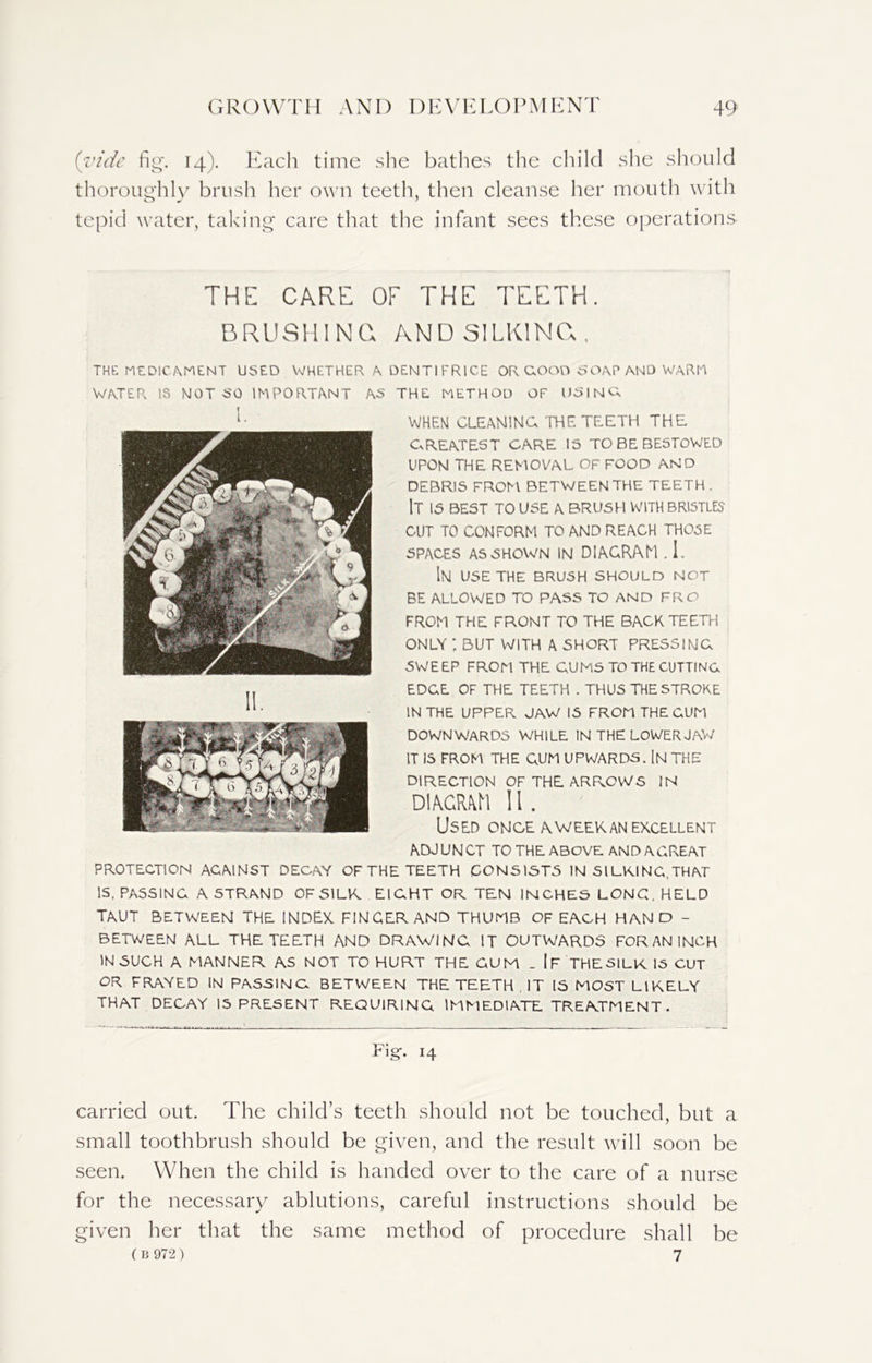 (vide fig'. 14). Each time she bathes the child she should thoroughly brush her own teeth, then cleanse her mouth with tepid water, taking care that the infant sees these operations THE CARE OF THE TEETH. BRUSHING AND SILKING, THE MEDICAMENT USED WHETHER A DENT I F RICE OR GOOD SOAP AND WARM WATER 18 MOT SO IMPORTANT AS THE METHOD OF USING, WHEN! GLEAMING THE TEETH THE GREATEST CARE IS TO BE BESTOWED UPON THE REMOVAL OF FOOD AND DEBRIS FROM BETWEENTHE TEETH. It is best to use a brush with bristles CUT TO CONFORM TO AND REACH THOSE SPACES AS SHOWN IN DIAGRAM . I. IN USE THE BRUSH SHOULD NOT BE ALLOWED TO PASS TO AND FRO FROM THE FRONT TO THE BACK TEETH ONLY , BUT WITH A SHORT PRESSING SWEEP FROM THE GUMS TO THE CUTTING EDGE OF THE TEETH . THUS THE STROKE IN THE UPPER JAW IS FROM THE GUM DOWNWARDS WHILE IN THE LOWER JAW IT IS FROM THE QUM UPWARDS. IN THE DIRECTION OF THE ARROWS IN DIAGRAM 11 . Used once a week an excellent ADJUNCT TO THE ABOVE AN DA GREAT PROTECTION AGAINST DECAY OF THE TEETH CONSISTS IN SILKING,THAT IS, PASSING A STRAND OF SILK EIGHT OR TEN INCHES LONG, HELD TAUT BETWEEN THE INDEX FINGER AND THUMB OF EACH HAND - BETWEEN ALL THE TEETH AND DRAWING IT OUTWARDS FORANINGH IN SUCH A MANNER AS NOT TO HURT THE GUM _ IF THE SILK. IS CUT OR FRAYED IN PASSING BETWEEN THE TEETH , IT IS MOST LIKELY THAT DECAY IS PRESENT REQUIRING IMMEDIATE TREATMENT. Fi g. 14 carried out. The child’s teeth should not be touched, but a small toothbrush should be given, and the result will soon be seen. When the child is handed over to the care of a nurse for the necessary ablutions, careful instructions should be given her that the same method of procedure shall be (B 972) 7