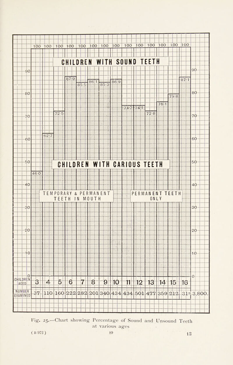 Fig-. 25.—Chart showing- Percentage of Sound and Unsound Teeth at various ages 12