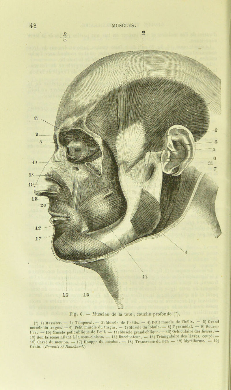 (*) 1) Massdler. — 2) Temporal. — 3) Muscle de l’hdlix. — 4) l'etit muscle do l’hdlix. — 5) Grand muscle du tragus. — 0) Petit muscle du tragus. — 7) Muscle du lobule. — S) Pyramidal. — 9 Sourci- licr. —10) Muscle petit oblique dc 1'ocil. — 11) Muscle grand oblique.— 12)Orbieulairc des lcvrcs.— 13) Son faisceau allant a la sous-eloison. — 14) Buccinatcur, — 15) Triangulairc des lcvrcs, coupd. — 10) Carrd du menton. — 17) Houppc du meuton. — 18) Transverse du nez. — 19) Myrtiforme. — 20) Ganin. [Bcaunis et Bouchard.)