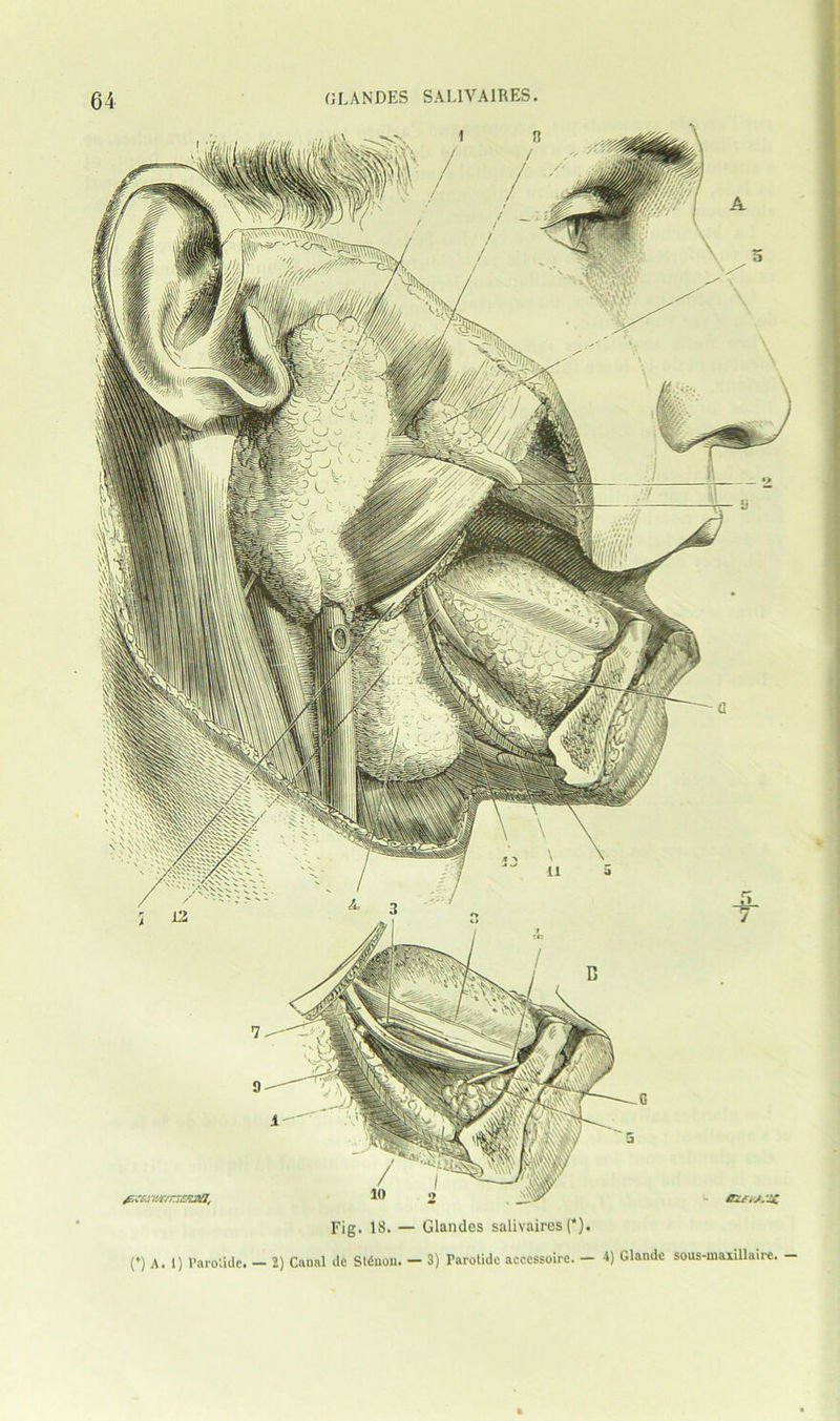 Fig. 18. — Glandes salivaires (*). (*) A. 1) l’aro'.Ulc. — 2) Canal de Slduou. — 3) Tarotide acccssoire. — ■*) Glandc sous-maiillaire. —