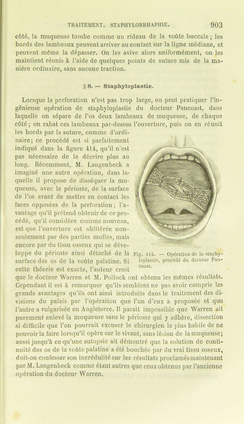 c6t6, la muqueuse tombe comme un rideau de la voute buccale; les bords des lambeaux peuvent arriver au contact sur la ligne mddiane, et peuvent mfime la d^passer. On les avive alors uniform6ment, on les maintient rdunis cl l’aide de quelques points de suture mis de la ma- nure ordinaire, sans aucune traction. § 8. — Staphyloplastie. Lorsque la perforation n’est pas trop large, on peut pratiquer l’in- gSnieuse operation de staphyloplastie du docteur Pancoast, dans laquelle on s6pare de l’os deux lambeaux de muqueuse, de chaque c6td; on rabat ces lambeaux par-dessus l’ouverture, puis on en r6unit les bords par la suture, comme d’ordi- naire; ce procddd est si parfaitement indiqud dans la figure 414, qu’il n’est pas n^cessaire de le d6crire plus au long. Rdcemment, M. Langenbeck a imaging une autre operation, dans la- quelle il propose de dissdquer la mu- queuse, avee le pdrioste, de la surface de l’os avant de mettre en contact les faces opposdes de la perforation; l’a- vantage qu’il pretend obtenir de ce pro- c6dd, qu’il consid&re comme nouveau, est que l’ouverture est oblitdrde non- seulement par des parties molles, mais encore par du tissu osseux qui se d6ve- loppe du p^rioste ainsi detache de la surface des os de la voute palatine. Si cette th6orie est exacte, l’auteur croit que le docteur Warren et M. Pollock ont obtenu les m6mes rdsultats. Cependant il est 5. remarquer qu’ils semblent ne pas avoir compris les grands avantages qu’ils ont ainsi introduits dans le trailement des di- visions du palais par l’opdration que l’un d’eux a propos6e et quo l’autre a vulgarisde en Angleterre. Il parait impossible que Warren ait purement enlev6 la muqueuse sans le pdrioste qui y adh&re, dissection si difficile que Ton pourrait excuscr le chirurgien le plus habile de ne pouvoirla faire lorsqu’il opbre sur le vivant, sans lesion de la muqueuse; aussi jusqu’5. ce qu’une aulopsie ait ddmontrd que la solution de conti- nuity des os de la voute palatine a did bouchde par du vrai tissu osseux, doit-on confesser son incredulity sur les rysultats proclamysmaintenant par M. Langenbeck comme ytant aulres que ceux obtcnus par l’ancienne ■operation du docteur Warren. Fig. 415. — Operation de la staphy- loplastie, precede du docteur Pan- coast.