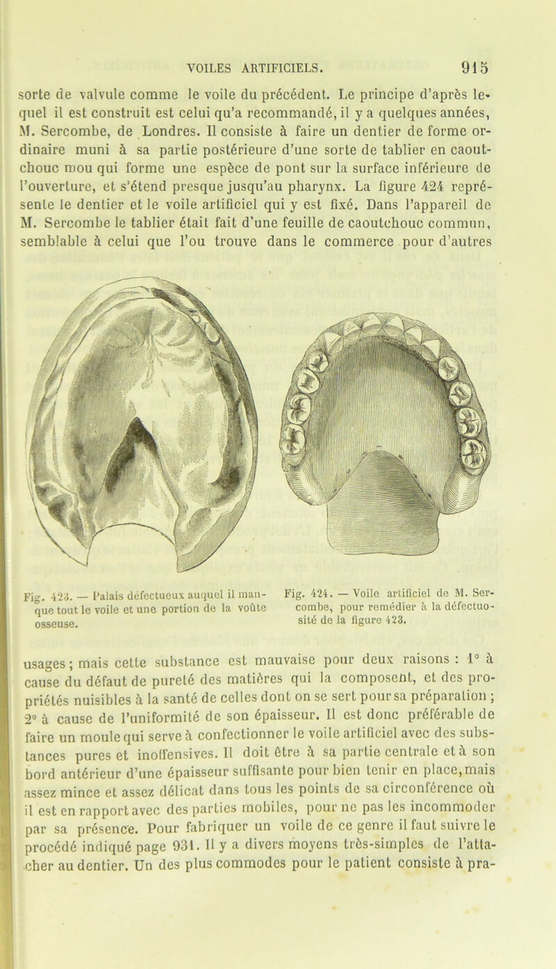 sorte de valvule comme le voile du precedent. Le principe d’aprds le- quel il est construit est celui qu’a recommandd, il y a quelques anndes, M. Sercombe, de Londres. Il consiste h faire un dentier de forme or- dinaire muni h sa parlie postdrieure d’unc sorte de tablier en caout- chouc mou qui forme une espdce de pont sur la surface infdrieure de l’ouverture, et s’dtend presque jusqu’au pharynx. La figure 424 reprd- senle le dentier et le voile arliflciel qui y est fixd. Dans l’appareil de M. Sercombe le tablier dtait fait d’une feuille de caoutchouc commun, semblable it celui que l’ou trouve dans le commerce pour d’autres Fig. 423. — falais defectueux auquel il man- Fig. 424. — Voile artificiel de M. Ser- que tout le voile etune portion de la voute combe, pour romedier h la diSfectuo- osseuse. sit6 de la figure 423. usages; mais cette substance est mauvaise pour deux raisons : 1° it cause du ddfaut de puretd des matures qui la composent, et des pro- pridtds nuisibles it la santd de cellos dont on se sert poursa preparation ; 2° a cause de I’uniformitd de son dpaisseur. Il est done prdfdrable de faire un moule qui serve it confectionner le voile artificiel avec des subs- tances pures et inollensives. Il doit dtre it sa partie centrale eth son bord antdrieur d’une dpaisseur suffisante pourbien tenir on place,mais assez mince et assez ddlicat dans tous les points de sa circonfdrence oil il est en rapport avec des parties mobiles, pourne pas les incommotler par sa prdsence. Pour fabriquer un voile de ce genre il faut suivre le proeddd indiqud page 931. Il y a divers moyens trds-simples tie l’atta- cher au dentier. Un des plus commodes pour le patient consiste it pra-