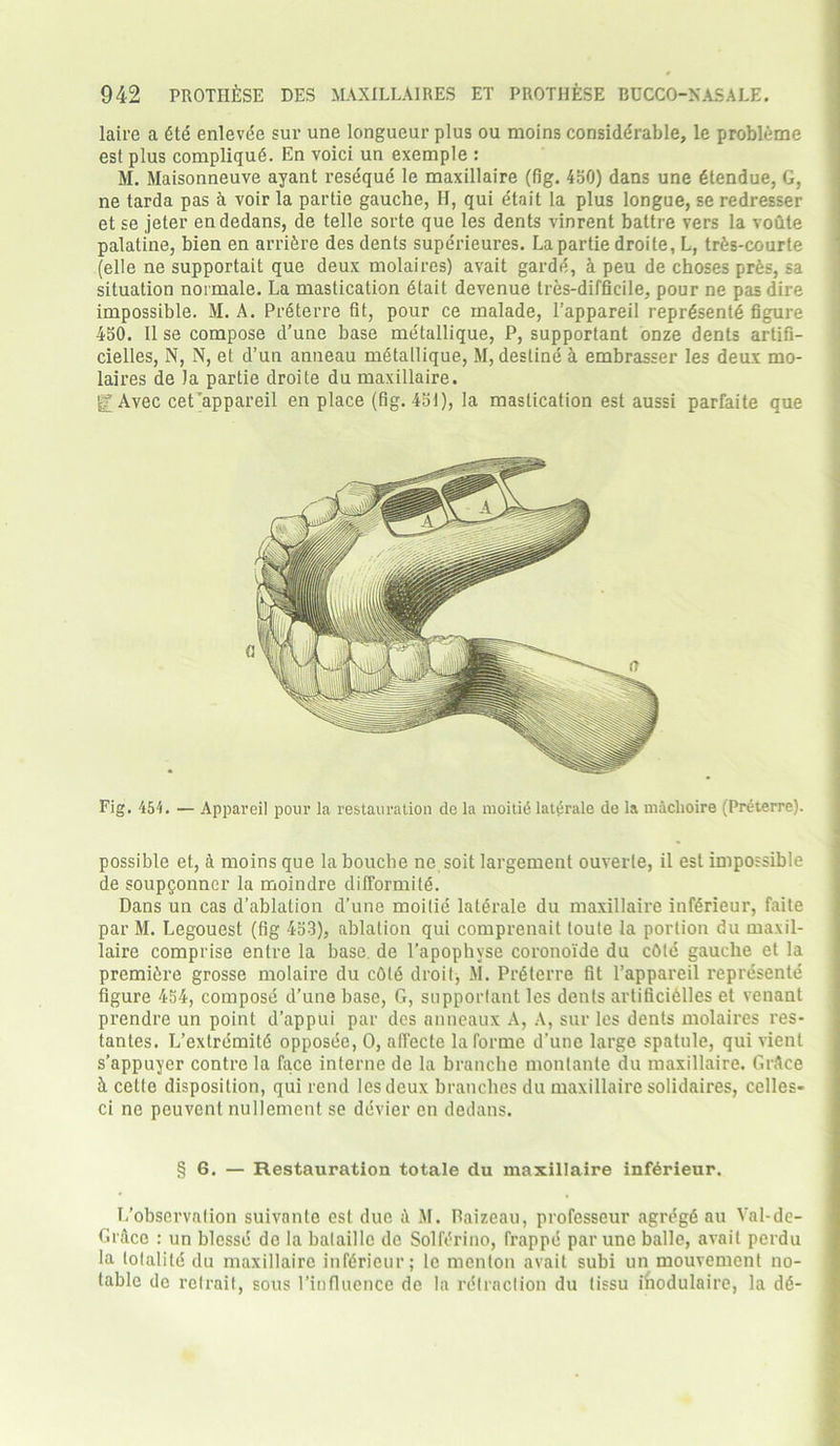 laire a 6te enlevce sur une longueur plus ou moins considerable, le probleme est plus compliqug. En voici un exemple : M. Maisonneuve ayant resdque le maxillaire (fig. 450) dans une gtendue, G, ne tarda pas h voir la partie gauche, If, qui etait la plus longue, se redresser et se jeter en dedans, de telle sorte que les dents vinrent battre vers la voOte palatine, bien en arri&re des dents superieures. La partie droite, L, trAs-courte (elle ne supportait que deux molaires) avait garde, a peu de choses pr6s, sa situation noi male. La mastication dtait devenue tres-difficile, pour ne pas dire impossible. M. A. Prdterre fit, pour ce malade, 1’appareil represents figure 450. II se compose d’une base me'tallique, P, supportant onze dents artifi- cielles, N, N, et d’un anneau mStallique, M, destine a embrasser les deux mo- laires de la partie droite du maxillaire. jg;Avec cet’appareil en place (fig. 451), la mastication est aussi parfaite que Fig. 454. — Appareil pour la restauration de la moitiii lattirale de la machoire (Preterre). possible et, 4 moins que la bouche ne soit largement ouverte, il est impossible de soupgonner la moindre difformitd. Dans un cas d’ablation d’une moitie lat<5rale du maxillaire infdrieur, faite par M. Legouest (fig 453), ablation qui comprenait loule la portion du maxil- laire comprise enlre la base de l’apophyse coronoide du cOte gauche et la premiere grosse molaire du c6(6 droit, M. Preterre fit l’appareil represente figure 454, compose d’une base, G, supportant les dents artificidlles et venant prendre un point d’appui par des anncaux A, A, sur les dents molaires res- tantes. L’extremitd opposee, 0, affccte la forme d’une large spatule, qui vient s’appuyer contrc la face interne de la branche montante du maxillaire. GrAce ii cetle disposition, qui rend les deux branches du maxillaire solidaires, celles- ci ne peuvent nullement se devier en dedans. § 6. — Restauration totale du maxillaire infdrieur. I/observation suivante est due A M. Raizeau, profcsseur agregd au Val-de- GrAce : un blesse de la balaillc do Solfdrino, frappe par une balle, avail perdu la totalittS du maxillaire infdrieur; le menton avait subi un mouvement no- table de retrait, sous l’influence de la retraction du tissu iliodulaire, la dd-