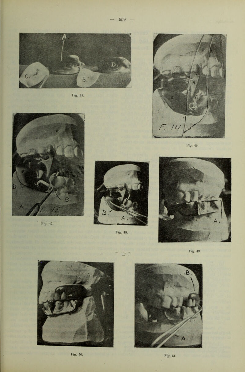 Fig. 49. Fig. 50. Fig. 51.