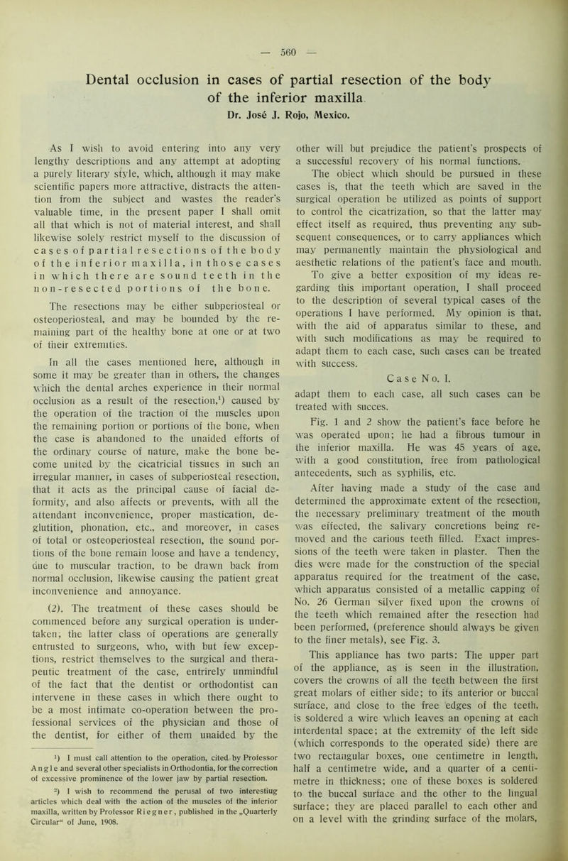 Dental occlusion in cases of partial resection of the body of the inferior maxilla Dr. Jose J. Rojo, Mexico. As I wish to avoid entering into any very lengthy descriptions and any attempt at adopting a purely literary style, which, although it may make scientific papers more attractive, distracts the atten- tion from the subject and wastes the reader's valuable time, in the present paper I shall omit all that which is not of material interest, and shall likewise solely restrict myself to the discussion of cases of partial resections of the body of the inferior maxilla, in those cases in which there are sound teeth in the no n- resected portions of the bone. The resections may be either subperiosteal or osteoperiosteal, and may be bounded by the re- maining part of the healthy bone at one or at two of their extremities. In all the cases mentioned here, although in some it may be greater than in others, the changes which the dental arches experience in their normal occlusion as a result of the resection,1) caused by the operation of the traction of the muscles upon the remaining portion or portions of the bone, when the case is abandoned to the unaided efforts of the ordinary course of nature, make the bone be- come united by the cicatricial tissues in such an irregular manner, in cases of subperiosteal resection, that it acts as the principal cause of facial de- formity, and also affects or prevents, with all the attendant inconvenience, proper mastication, de- glutition, phonation, etc., and moreover, in cases of total or osteoperiosteal resection, the sound por- tions of the bone remain loose and have a tendency, due to muscular traction, to be drawn back from normal occlusion, likewise causing the patient great inconvenience and annoyance. (2). The treatment of these cases should be commenced before any surgical operation is under- taken, the latter class of operations are generally entrusted to surgeons, who, with but few excep- tions, restrict themselves to the surgical and thera- peutic treatment of the case, entrirely unmindful of the fact that the dentist or orthodontist can intervene in these cases in which there ought to be a most intimate co-operation between the pro- fessional services of the physician and those of the dentist, for either of them unaided by the >) 1 must call attention to the operation, cited by Professor Angle and several other specialists in Orthodontia, for the correction of excessive prominence of the lower jaw by partial resection. 2) 1 wish to recommend the perusal of two interesting articles which deal with the action of the muscles of the inferior maxilla, written by Professor R i e gn er, published in the ..Quarterly Circular of June, 1908. other will but prejudice the patient's prospects of a successful recovery of his normal functions. The object which should be pursued in these cases is, that the teeth which are saved in the surgical operation be utilized as points of support to control the cicatrization, so that the latter may effect itself as required, thus preventing any sub- sequent consequences, or to carry appliances which may permanently maintain the physiological and aesthetic relations of the patient’s face and mouth. To give a better exposition of my ideas re- garding this important operation, I shall proceed to the description of several typical cases of the operations 1 have performed. My opinion is that, with the aid of apparatus similar to these, and with such modifications as may be required to adapt them to each case, such cases can be treated ■with success. Case No. I. adapt them to each case, all such cases can be treated with succes. Fig. 1 and 2 show the patient's face before he was operated upon; he had a fibrous tumour in the inferior maxilla. He was 45 years of age, with a good constitution, free from pathological antecedents, such as syphilis, etc. After having made a study of the case and determined the approximate extent of the resection, the necessary preliminary treatment of the mouth was effected, the salivary concretions being re- moved and the carious teeth filled. Exact impres- sions of the teeth were taken in plaster. Then the dies were made for the construction of the special apparatus required for the treatment of the case, which apparatus consisted of a metallic capping of No. 26 German silver fixed upon the crowns of the teeth which remained after the resection had been performed, (preference should always be given to the finer metals), see Fig. 3. This appliance has two parts: The upper part of the appliance, as is seen in the illustration, covers the crowns of all the teeth between the first great molars of either side; to its anterior or buccal surface, and close to the free edges of the teeth, is soldered a wire which leaves an opening at each interdental space; at the extremity of the left side (which corresponds to the operated side) there are two rectangular boxes, one centimetre in length, half a centimetre wide, and a quarter of a centi- metre in thickness; one of these boxes is soldered to the buccal surface and the other to the lingual surface; they are placed parallel to each other and on a level with the grinding surface of the molars,