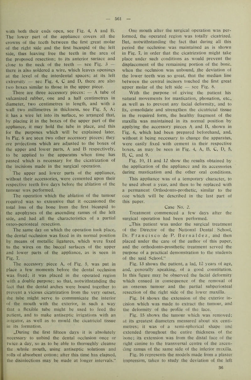 with both their ends open, see Fig. 4, A and B. The lower part of the appliance covers all the crowns of the teeth between the first great molar of the right side and the first bicuspid of the left side, thus leaving free the teeth in the area of the proposed resection; to its anterior surtace and close to the neck of the teeth — see Fig. 3 — there is also soldered a wire, which leaves openings at the level of the interdental spaces; at its left extremity — see Fig. 4, C and D, there are also two boxes similar to those in the upper piece. There are three accessory pieces: — A tube of vulcanized rubber, one and a half centimetres in diameter, two centimetres in length, and with a wall two millimetres in thickness, see Fig. 5, A; it has a wire let into its surface, so arranged that, by placing it in the boxes of the upper part of the appliance, it may hold the tube in place, and this for the purposes which will be explained later. In Fig. 6 are seen two other accessory pieces; they are projections which are adjusted to the boxes of the upper and lower parts. A and B respectively, to be applied to the apparatus when time has passed which is necessary for the cicatrization of the incisions made in the surgical operation. The upper and lower parts of the appliance, without their accessories, were cemented upon their respective teeth five days before the ablation of the tumour was performed. The operation which the ablation of the tumour required was so extensive that it occasioned the total loss of the bone from the first bicuspid to the apophyses of the ascending ramus of the left side, and had all the characteristics of a partial osteo-periosteal resection. The same day on which the operation took place, the dental occlusion was fixed in its normal position by means of metallic ligatures, which were fixed to the wires on the buccal surfaces of the upper and lower parts of the appliance, as is seen in Fig. 7. The accessory piece A, of Fig. 5, was put in place a few moments before the dental occlusion was fixed; it was placed in the operated region with a double purpose; so that, notwithstanding the fact that the dental arches were bound together to prevent a vicious cicatrization from the very outset, the tube might serve to communicate the interior of the mouth with the exterior, in such a way that a flexible tube might be used to feed the patient, and to make antiseptic irrigations with an irrigator, as well as to mould the cicatricial tissue in its formation. ..During the first fifteen days it is absolutely necessary to unbind the dental occlusion once or twice a day, so as to be able to thoroughly cleanse the whole mouth, using antiseptic solutions and rolls of absorbent cotton; after this time has elapsed, the disinfections may be made at longer intervals.'1 One mouth after the surgical operation was per- formed, the operated region was totally cicatrized. But, notwithstanding the fact that during all this period the occlusion was maintained as is shown in Fig. 7, in order that the cicatrization might take place under such conditions as would prevent the displacement of the remaining portion oi the bone, when the occlusion was unbound, the deviation of the lower teeth was so great, that the median line between the central incisors touched the first great upper molar of the left side — see Fig. 8. With the purpose of giving the patient his natural movements for mastication, phonation, etc., as well as to prevent any facial deformity, and to fix, consolidate and strengthen the cicatricial tissue in the required form, the healthy fragment of the maxilla was maintained in its normal position by applying the accessory pieces A and B, shown in Fig. 6, which had been prepared beforehand, and, without it being necessary to change the apparatus, were easily fixed with cement in their respective boxes, as may be seen in Fig. 4, A, B, C, D, 5, B, C, and 9. Fig. 10, 11 and 12 show the results obtained by the application of the appliance and its accessories during mastication and the other oral conditions. This appliance was of a temporary character, to be used about a year, and then to be replaced with a permanent Orthodonto-prothetic, similar to the one which will be described in the last part of this paper. Case No. 2. Treatment commenced a few days after the surgical operation had been performed. „This patient was under the surgical treatment of the Director of the National Dental School, Dr. Francisco de P. Bernaldez, and then placed under the care of the author of this paper, and the orthodonto-prosthetic treatment served the purpose of a practical demonstration to the students of the said School. Fig. 13 shows the patient, a lad, 12 years of age, and, generally speaking, of a good constitution. In this figure may be observed the facial deformity which ensued in consequence of the removal of an osseous tumour and the partial subperiosteal resection of the right side of the lower maxilla. Fig. 14 shows the extension of the exterior in- cision which was made to extract the tumour, and the deformity of the profile of the face. Fig. 15 shows the tumour which was removed: at its greatest diameters measured about six centi- metres; it was of a semi-spherical shape and extended throughout the entire thickness of the bone; its extension was from the distal face of the right canine to the transversal centre of the ascen- ding ramus of the same side of the inferior maxilla. Fig. 16 represents the models made from a plaster impression, taken to study the deviation of the left 36