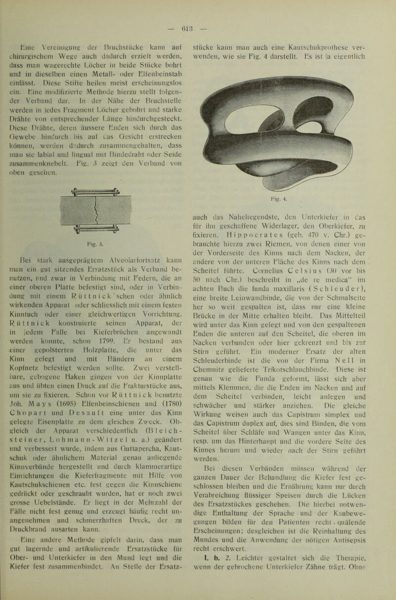 Fine Vereinigung dcr Bruchstiicke kami auf chirurgischem Wege auch dadurch erzielt werden, dass man wagerechte Locher in heide Stiickc bohrt u;id in dieselben einen Metall- oder Elfenbeinstab einlasst. Diese Stifte heilen meist erscheinungslos ein. Bine modifizierte Methode hierzu stellt folgen- der Verband dar. In dcr Niihe der Bruchstelle werden in jedcs Fragment Locher gebohrt und Starke Drahte von entsprechender Lange hindurchgesteckt. Diese Drahte, deren iiussere Enden sich durch das (iewcbc hindurch iris auf das Gesicht erstrecken konnen, werden dadurch zusammengehalten, dass man sic labial und lingual mit Bindedraht oder Seide zusammenknebelt. Fig. 3 zeigt den Verband von oben gesehcn. Bei stark ausgepragtem Alveolarfortsatz kann man ein gut sitzendes Ersatzstiick als Verband be- nutzeu, und zwar in Verbindung mit Federn, die an einer oberen Platte befestigt sind, oder in Verbin- dung mit einem R ii 11 n i c k ’ schen oder ahnlich wirkenden Apparat oder schliesslich mit einem testen Kinntuch oder einer gleichwertigen Vorrichtung. R ii 11 n i c k konstruierte seinen Apparat, der in j'edem Falle bei Kieferbrtichen angewandt werden konnte, schon 1799. Er bestand aus einer gepolsterten Holzplatte, die untcr das Kinn gelegt und mit Bandern an einem Kopfnetz befestigt werden sollte. Zwei verstell- bare, gebogene Haken gingen von der Kinnplatte aus und iibten einen Druck auf die Erakturstiicke aus, uni sie zu fixieren. Schorr vor R ii 11 n i c k benutzte Joh. Mays (1695) Elfenbeinschienen und (1780) C ho part und Desault eine unter das Kinn gelegte Eisenplatte zu dem gleichen Zweck. Ob- gleich der Apparat verschiedentlich (Bleich- Steiner, L o h m a n n - W i t z e I u. a.) geandert und verbessert wurde, indem aus Guttapercha, Kaut- setruk oder ahnlichem Material genau anliegende Kinnverbande hergestellt und durch klamnrerartige Eiurichtungen die Kieferfragmente mit Hilfe von Kautschukschienen etc. fest gegen die Kinnschiene gedriickt oder geschraubt wurden, hat er noch zwei grosse Uebelstande. Er liegt in der Mehrzahl der Falle nicht fest genug und erzeugt lraufig recht utr- angenehmen und schmerzhaften Druck, der zu Druckbrand ausarterr kann. Eine andere Methode gipfelt darin, dass man gut iagernde und artikulierende Ersatzstiicke fin Ober- und Unterkiefer in den Mund legt urrd die Kiefer fest zusammenbindet. An Stelle der Ersatz- stiicke kann man auch eine Kautschukprothese ver- wenden, wie sie Fig. 4 darstellt. Es ist ;ia eigentlich Fig. 4. auch das Naheliegendste, den Unterkiefer in cas fiir ihn geschaffetre Widerlager, den Oberkiefer, zu fixieren. Hippocrates (geb. 470 v. Chr.) ge- brauchte hierzu zwei Riemen, von denen einer von der Vorderseite des Kinns nach detn Nacken, der andere von der unteren Elache des Kinns nach dem Scheitel fiihrte. Cornelius Celsius (30 vor bis 50 nach Chr.) beschreibt in „de re rnedica“ im achten Buch die funda maxillaris (Schleuder), eine breite Leinwandbinde, die von der Schmalseite her so weit gespalten ist, dass nur eine kleine Briicke in der Mitte erhalten bleibt. Das Mittelteil wird unter das Kinn gelegt und von den gespaltenen Enden die unteren auf den Scheitel, die oberen im Nacken verbunden oder hier gekreuzt und bis zur Stirn gefiihrt. Ein moderner Ersatz der alten Schleuderbinde ist die von der Firma Nell in Chemnitz gelieferte Trikotschlauchbinde. Diese ist genau wie die Funda geformt, iasst sich aber mittels Klemmett, die die Enden irn Nacken und auf dem Scheitel verbinden, leicht anlegen und schwacher und starker anziehen. Die gleiche Wirkung weisen auch das Capistrum simplex und das Capistrum duplex auf, dies sind Binden, die vom Scheitel iiber Schlafe und Wangen unter das Kinn, resp. urn das Hinterhau.pt und die vordere Seite des Kinnes herunr und wieder itach der Stirn gefiihrt werden. Bei diesen Verbanden miissen wahrend der ganzen Dauer der Behandlung die Kiefer fest ge- schlossen bleiben und die Ernahrung kann nur durch Verabreichung fliissiger Speisen durch die Liicken des Ersatzstiickes geschehen. Die hierbei notwen- dige Enthaltung der Sprache und der Kaubewe- gungen bilden fiir den Patienten recht. qualende Erscheinungen; desgleichen ist die Reinhaltung des Mimdes und die Anwendung der notigen Antisepsis recht erschwcrt. I. b. 2. Leichter gestaltet sich die Therapie, wenn der gebrochetie Unterkiefer Zahne tragt. Ohne