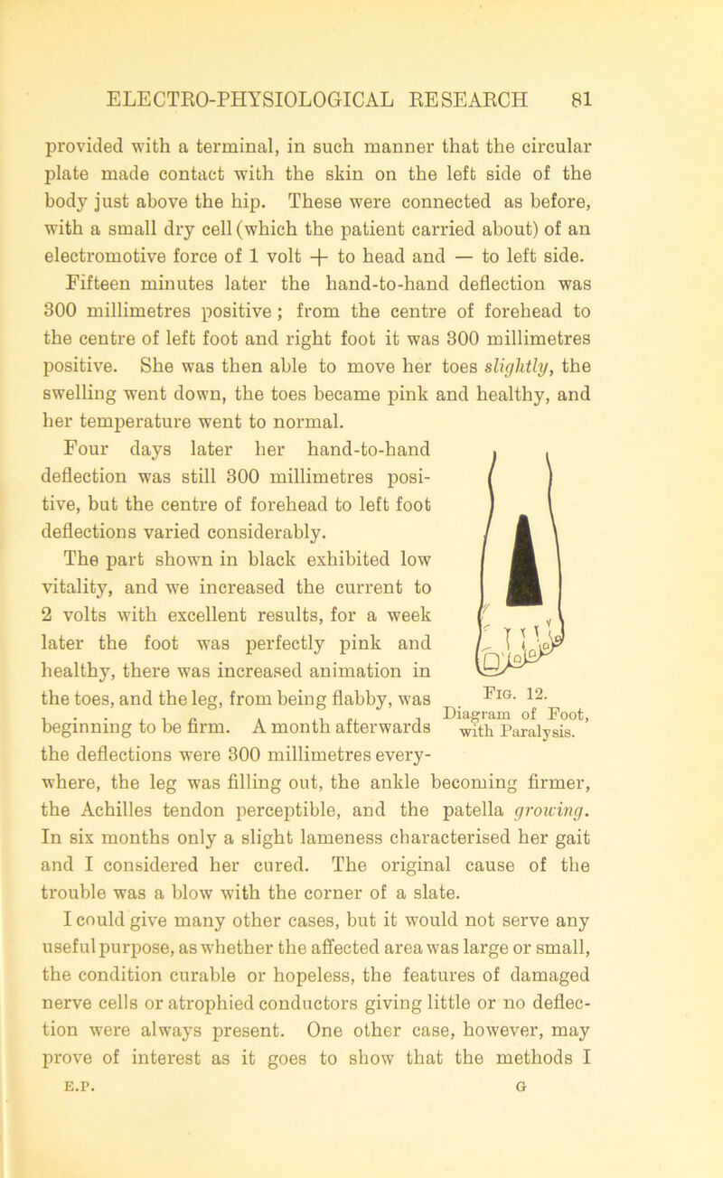 provided with a terminal, in such manner that the circular plate made contact with the skin on the left side of the body just above the hip. These were connected as before, with a small dry cell (which the patient carried about) of an electromotive force of 1 volt + to head and — to left side. Fifteen minutes later the hand-to-hand deflection was 300 millimetres positive ; from the centre of forehead to the centre of left foot and right foot it was 300 millimetres positive. She was then able to move her toes slightly, the swelling went down, the toes became pink and healthy, and her temperature went to normal. Four days later her hand-to-hand deflection was still 300 millimetres posi- tive, but the centre of forehead to left foot deflections varied considerably. The part shown in black exhibited low vitality, and w7e increased the current to 2 volts with excellent results, for a week later the foot was perfectly pink and healthy, there was increased animation in the toes, and the leg, from being flabby, was beginning to be firm. A month afterwards ^wTth Paralysis?*’ the deflections were 300 millimetres every- where, the leg was filling out, the ankle becoming firmer, the Achilles tendon perceptible, and the patella groicing. In six months only a slight lameness characterised her gait and I considered her cured. The original cause of the trouble was a blow with the corner of a slate. I could give many other cases, but it would not serve any useful purpose, asw'hether the affected area was large or small, the condition curable or hopeless, the features of damaged nerve cells or atrophied conductors giving little or no deflec- tion were always present. One other case, however, may prove of interest as it goes to show that the methods I E.P. G