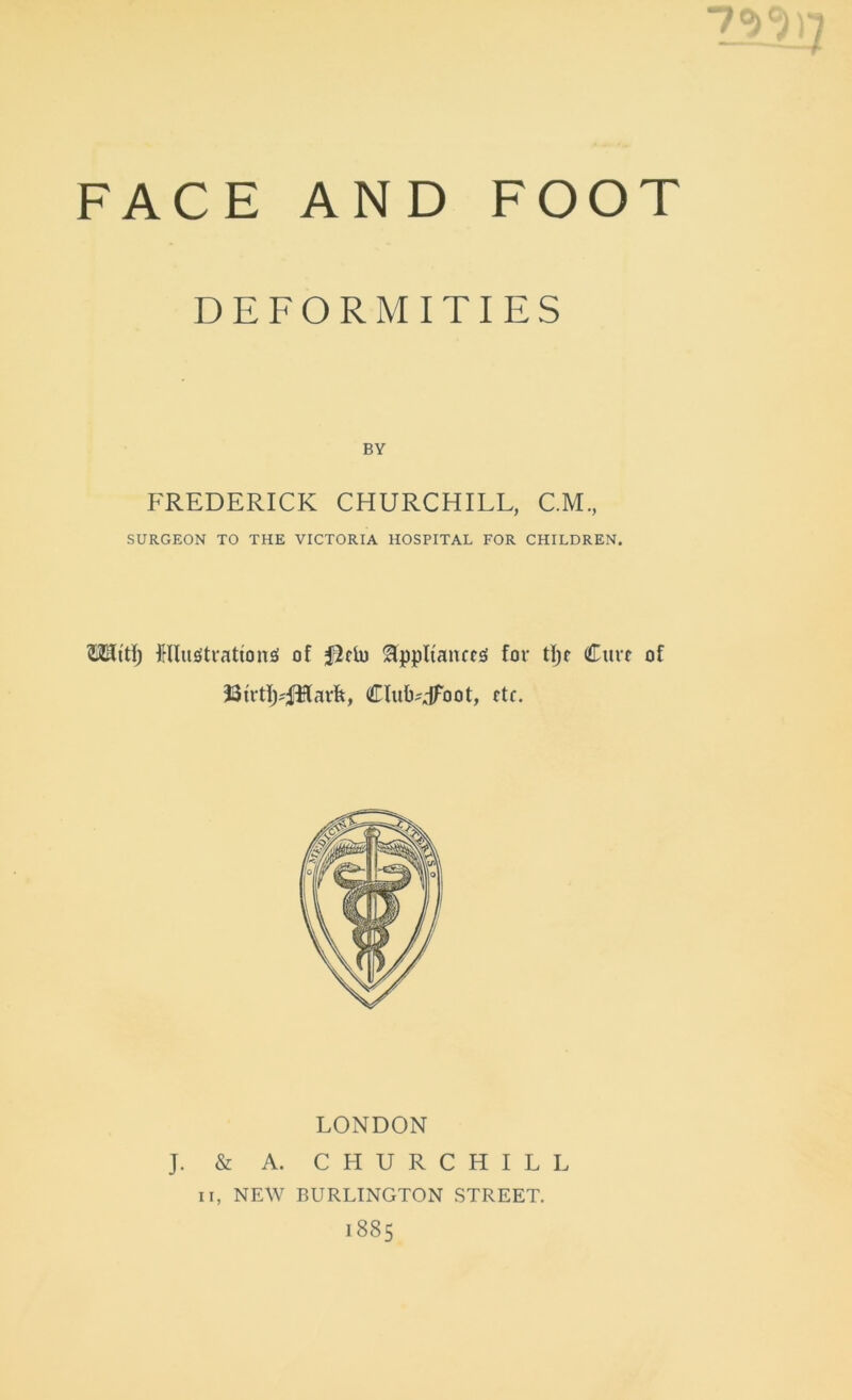 DEFORMITIES BY FREDERICK CHURCHILL, C.M., SURGEON TO THE VICTORIA HOSPITAL FOR CHILDREN. Ulugtrattonsi of f^rlu Appliances for tl)e Cure of 33frtIj?JHarfe, CIuUdFoot, rtr. LONDON J. & A. CHURCHILL ii, NEW BURLINGTON STREET. 1885