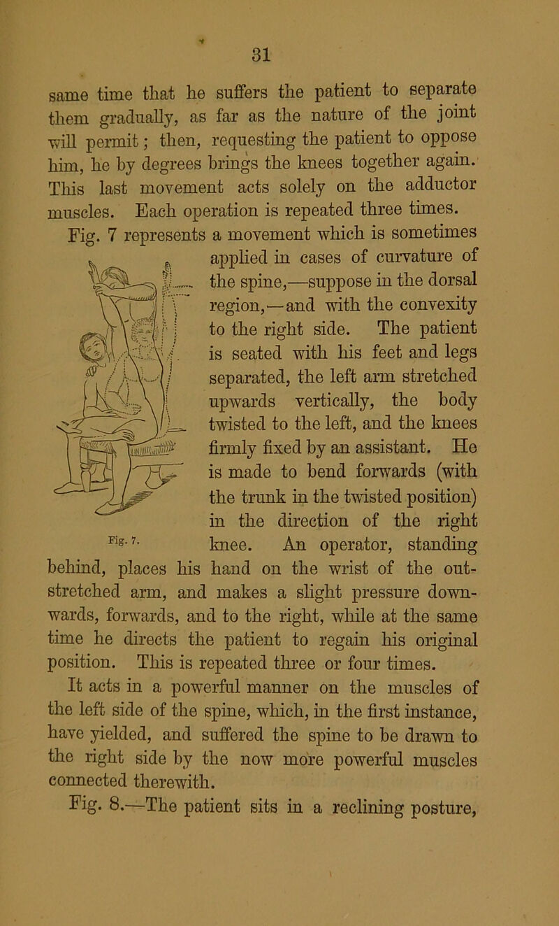 same time that he suffers the patient to separate them gradually, as far as the nature of the joint ■will permit; then, requesting the patient to oppose him, he by degrees brings the knees together again. This last movement acts solely on the adductor muscles. Each operation is repeated three times. Fig. 7 represents a movement ■which is sometimes applied in cases of curvature of the spine,—suppose in the dorsal region,—and -with the convexity to the right side. The patient is seated with his feet and legs separated, the left arm stretched upwards vertically, the body twisted to the left, and the knees firmly fixed by an assistant. He is made to bend forwards (with the trunk in the t^wisted position) in the direction of the right knee. An operator, standing behind, places his hand on the ■wrist of the out- stretched arm, and makes a slight pressure do’wn- wards, forwards, and to the right, while at the same time he directs the patient to regain his original position. This is repeated three or four times. It acts in a powerful manner on the muscles of the left side of the spine, which, in the first instance, have yielded, and suffered the spine to be drawn to the right side by the now more powerful muscles connected therewith. Fig. 8.—The patient sits in a reclining posture,