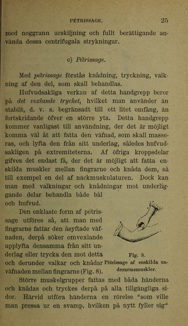 med noggrann urskiljning och fullt berättigande an- vända dessa centrifugala strykningar. c) Pétrissage. Med pétrissage förstås knådning, tryckning, valk- ning af den del, som skall behandlas. Hufvudsakliga verkan af detta handgrepp beror pä det vexlande trycket, hvilket man använder än stabilt, d. v. s. begränsadt till ett litet omfång, än fortskridande öfver en större yta. Detta handgrepp kommer vanligast till användning, der det är möjligt komma väl åt att fatta den väfnad, som skall masse- ras, och lyfta den från sitt underlag, således hufvud- sakligen på extremiteterna. Af öfriga kroppsdelar gifves det endast få, der det är möjligt att fatta en- skilda muskler mellan fingrarne och knåda dem, så till exempel en del af nackmuskulaturen. Dock kan man med valkningar och knådningar mot underlig- gande delar behandla både bål och hufvud. Den enklaste form af pétris- sage utföres så, att man med fingrarne fattar den åsyftade väf- naden, derpå söker omvexlande upplyfta densamma från sitt un- derlag eller trycka den mot detta och derunder valkar och knådar Pétrissage af enskilda un- väfnaden mellan fingrarne (Fig. 8). derarmsmuskier. Större muskelgrupper fattas med båda händerna och knådas och tryckes derpå på alla tillgängliga si- dor. Härvid utföra händerna en rörelse “som ville man pressa ur en svamp, hvilken på nytt fyller sig“ Fig. 8.