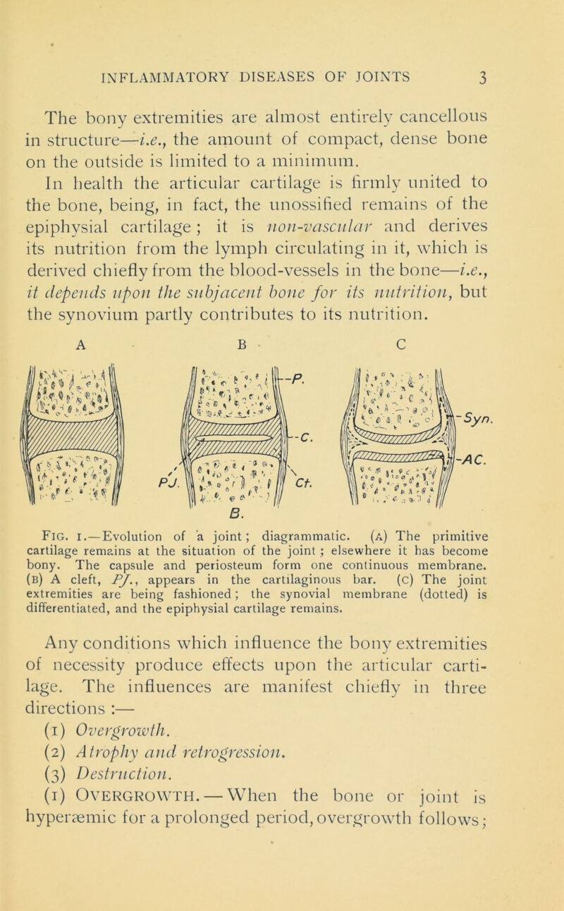 The bony extremities are almost entirely cancellous in structure—/.<?., the amount of compact, dense bone on the outside is limited to a minimum. In health the articular cartilage is firmly united to the bone, being, in fact, the unossified remains of the epiphysial cartilage; it is iion-vascular and derives its nutrition from the lymph circulating in it, which is derived chiefly from the blood-vessels in the bone—i.e., it depends upon the subjacent bone for its nutrition, but the synovium partly contributes to its nutrition. A B C Fig. i.—Evolution of a joint; diagrammatic. (a) The primitive cartilage remains at the situation of the joint; elsewhere it has become bony. The capsule and periosteum form one continuous membrane. (b) A cleft, PJ., appears in the cartilaginous bar. (c) The joint extremities are being fashioned; the synovial membrane (dotted) is differentiated, and the epiphysial cartilage remains. Any conditions which influence the bony extremities of necessity produce effects upon the articular carti- lage. The influences are manifest chiefly in three directions :— (1) Overgrowth. (2) Atrophy and retrogression. (3) Destruction. (1) Overgrowth. — When the bone or joint is hyperaemic for a prolonged period,overgrowth follows;