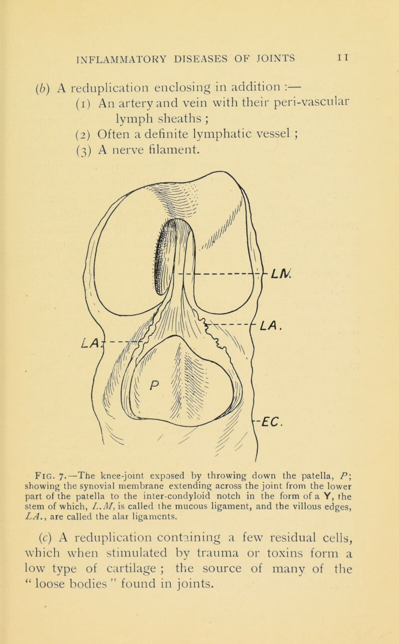 (b) A reduplication enclosing in addition :— (1) An artery and vein with their peri-vascular lymph sheaths ; (2) Often a definite lymphatic vessel ; (3) A nerve filament. Fig. 7.—The knee-joint exposed by throwing down the patella, P; showing the synovial membrane extending across the joint from the lower part of the patella to the inter-condyloid notch in the form of a Y, the stem of which, L.M, is called the mucous ligament, and the villous edges, LA., are called the alar ligaments. (c) A reduplication containing a few residual cells, which when stimulated by trauma or toxins form a low type of cartilage ; the source of many of the “ loose bodies ” found in joints.