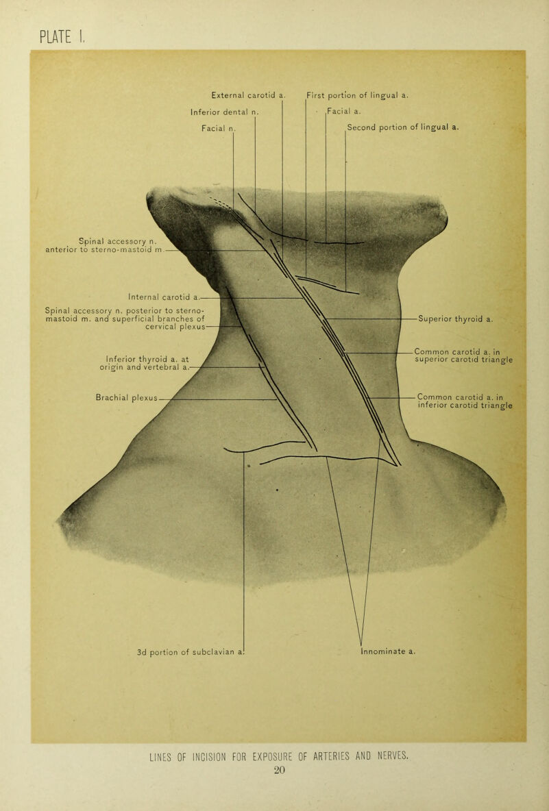 LINES OF INCISION FOR EXPOSURE OF ARTERIES AND NERVES. 20