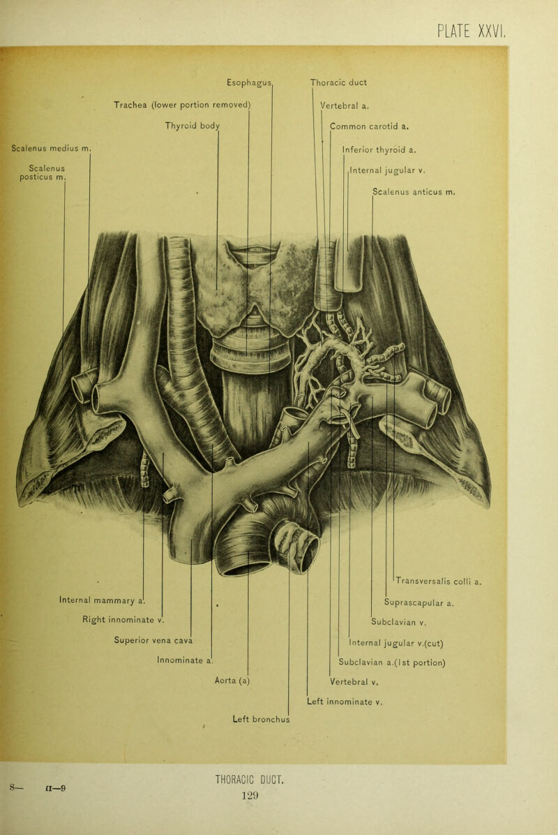 Transversalis colli a. Thoracic duct Vertebral a. Common carotid a. Inferior thyroid a. Internal jugular v. Scalenus anticus m, Esophagus Trachea (lower portion remov Thyroid body Scalenus medius m. Scalenus posticus m Internal mammary a. Right innominate v. Superior vena cava Innominate a. Aorta (a) Suprascapular a. Subclavian v. Internal jugular v.(cut) Subclavian a.(1st portion) Vertebral v. Left innominate v. Left bronchus S— a—9 THORACIC DUCT.