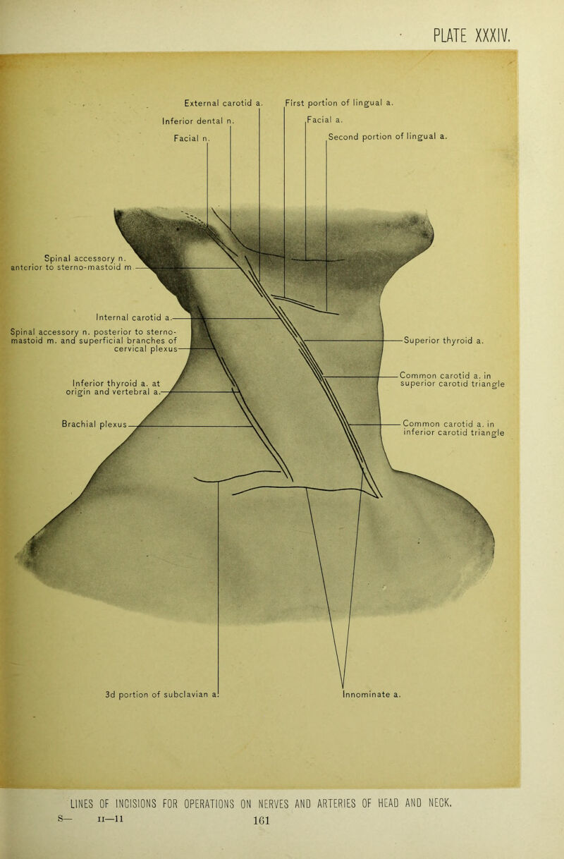 LINES OF INCISIONS FOR OPERATIONS ON NERVES AND ARTERIES OF HEAD AND NECK.