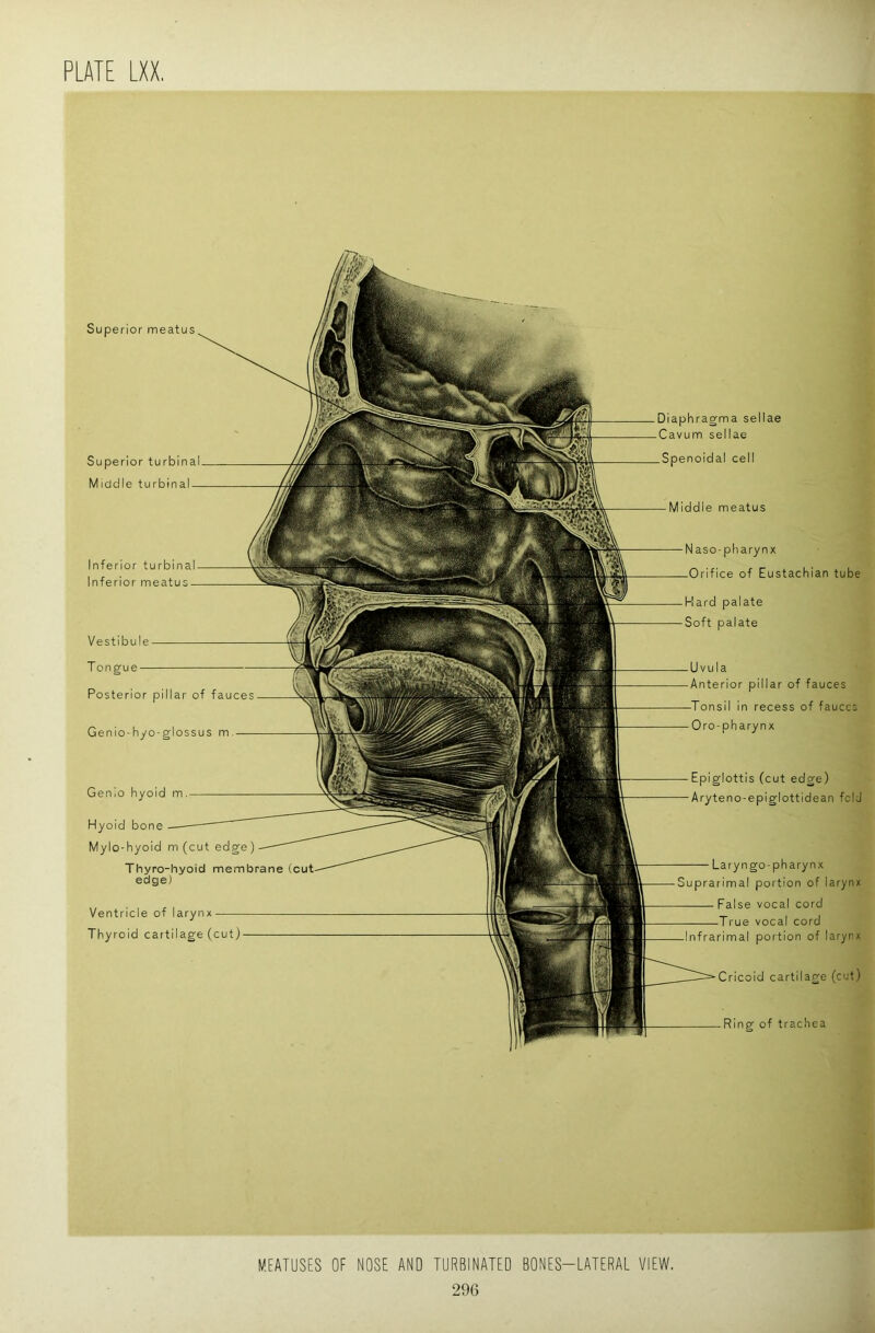 Superior turbinal Middle turbinal — Superior meatus Inferior turbinal Inferior meatus- Vestibule Tongue Posterior pillar of fauces Genlo-hyo-glossus m. Naso-pharynx -Orifice of Eustachian tube Kard palate Soft palate Uvula Anterior pillar of fauces Tonsil in recess of fauces Oro-pharynx Epiglottis (cut edge) Aryteno-epiglottidean fcid Ring of trachea Genio hyoid m. Hyoid bone Mylo-hyoid m (cut edge) Thyro-hyoid membrane (c edge) Ventricle of larynx Thyroid cartilage (cut) Laryngo-pharynx Suprarimal portion of larynx False vocal cord -True vocal cord Infrarimal portion of larynx Cricoid cartilage (cut) Middle meatus Diaphragma sellae Cavum sellae Spenoidal cell MEATUSES OF NOSE AND TURBINATED BONES-LATERAL VIEW.