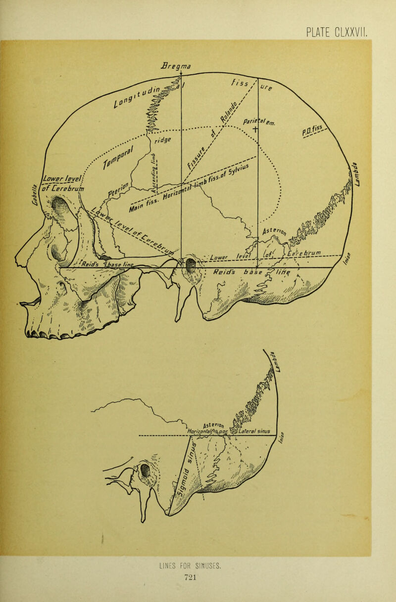 Cabella LINES FOR SINUSES, Lambda