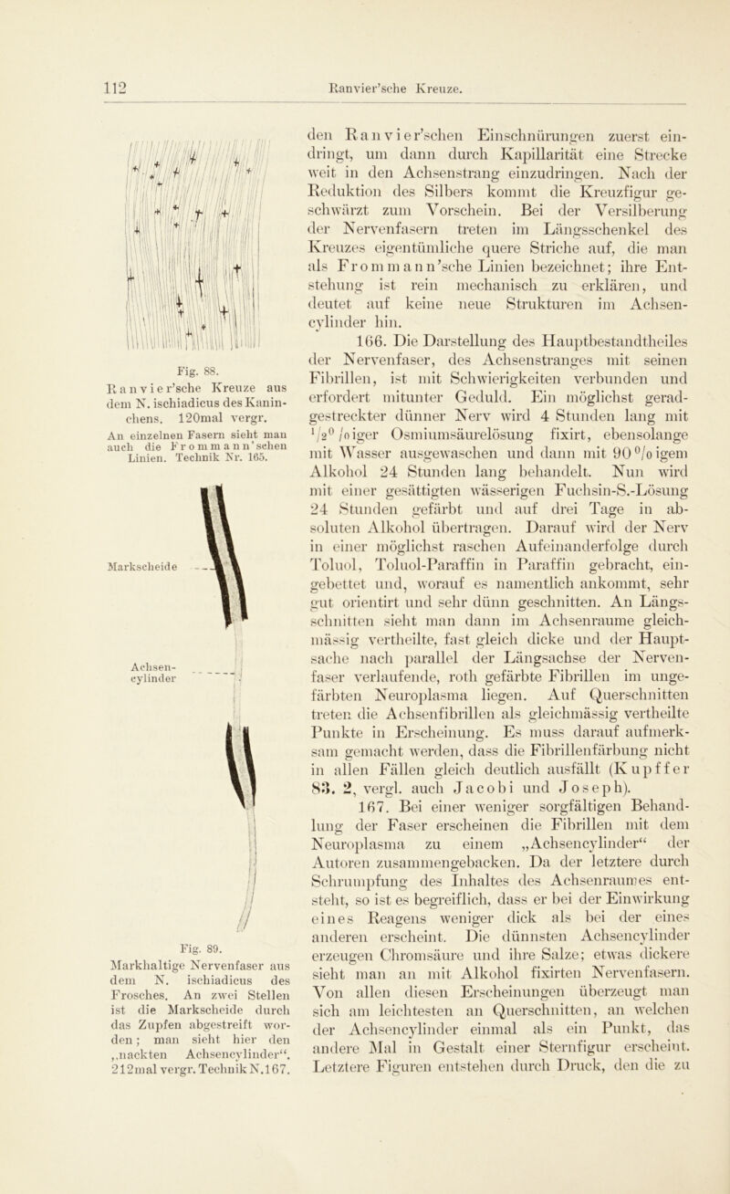 Fig. 88. Ranvier’sche Kreuze aus dem N. ischiadicus des Kanin- chens. 120mal vergr. An einzelnen Fasern sieht man aucli die Frommann1 sehen Linien. Technik Nr. 165. Markscheide Aehsen- cylinder Fig. 89. Markhaltige Nervenfaser aus dem N. ischiadicus des Frosches. An zwei Stellen ist die Markscheide durch das Zupfen abgestreift wor- den ; man sieht hier den ,,nackten Achsencylinder“. 212mal vergr. TeclinikN.167. den R a n v i e r’schen Einschnürungen zuerst ein- dringt, um dann durch Kapillarität eine Strecke weit in den Achsenstrang einzudringen. Nach der Reduktion des Silbers kommt die Kreuzfigur ge- schwärzt zum Vorschein. Bei der Versilberung der Nervenfasern treten im Längsschenkel des Kreuzes eigentümliche quere Striche auf, die man als From m an n’sche Linien bezeichnet; ihre Ent- stehung ist rein mechanisch zu erklären, und deutet auf keine neue Strukturen im Achsen- cylinder hin. 166. Die Darstellung des Hauptbestandtheiles der Nervenfaser, des Achsen Stranges mit seinen Fibrillen, ist mit Schwierigkeiten verbunden und erfordert mitunter Geduld. Ein möglichst gerad- gestreckter dünner Nerv wird 4 Stunden lang mit 1/2°/oiger Osmiumsäurelösung fixirt, ebensolange mit Wasser ausgewaschen und dann mit 90°/oigem Alkohol 24 Stunden lang behandelt. Nun wird mit einer gesättigten wässerigen Fuchsin-S.-Lösung 24 Stunden gefärbt und auf drei Tage in ab- soluten Alkohol übertragen. Darauf wird der Nerv in einer möglichst raschen Aufeinanderfolge durch Toluol, Toluol-Paraffin in Paraffin gebracht, ein- gebettet und, worauf es namentlich ankommt, sehr gut orientirt und sehr dünn geschnitten. An Längs- schnitten sieht man dann im Achsenraume gleich- mässig vertheilte, fast gleich dicke und der Haupt- sache nach parallel der Längsachse der Nerven- faser verlaufende, roth gefärbte Fibrillen im unge- färbten Neuroplasma liegen. Auf Querschnitten treten die Achsenfibrillen als gleichmässig vertheilte Punkte in Erscheinung. Es muss darauf aufmerk- sam gemacht werden, dass die Fibrillenfärbung nicht in allen Fällen gleich deutlich ausfällt (Ivupffer 83. 2, vergl. auch Jacobi und Joseph). 167. Bei einer weniger sorgfältigen Behand- lung; der Faser erscheinen die Fibrillen mit dem c> Neuroplasma zu einem „Achsencylinder“ der Autoren zusammen gebacken. Da der letztere durch Schrumpfung des Inhaltes des Achsenraumes ent- steht, so ist es begreiflich, dass er bei der Einwirkung eines Reagens weniger dick als bei der eines anderen erscheint. Die dünnsten Achsencylinder erzeugen Chromsäure und ihre Salze; etwas dickere sieht man an mit Alkohol fixirten Nervenfasern. Von allen diesen Erscheinungen überzeugt man sich am leichtesten an Querschnitten, an welchen der Achsencylinder einmal als ein Punkt, das andere Mal in Gestalt einer Sternfigur erscheint. Letztere Figuren entstehen durch Druck, den die zu