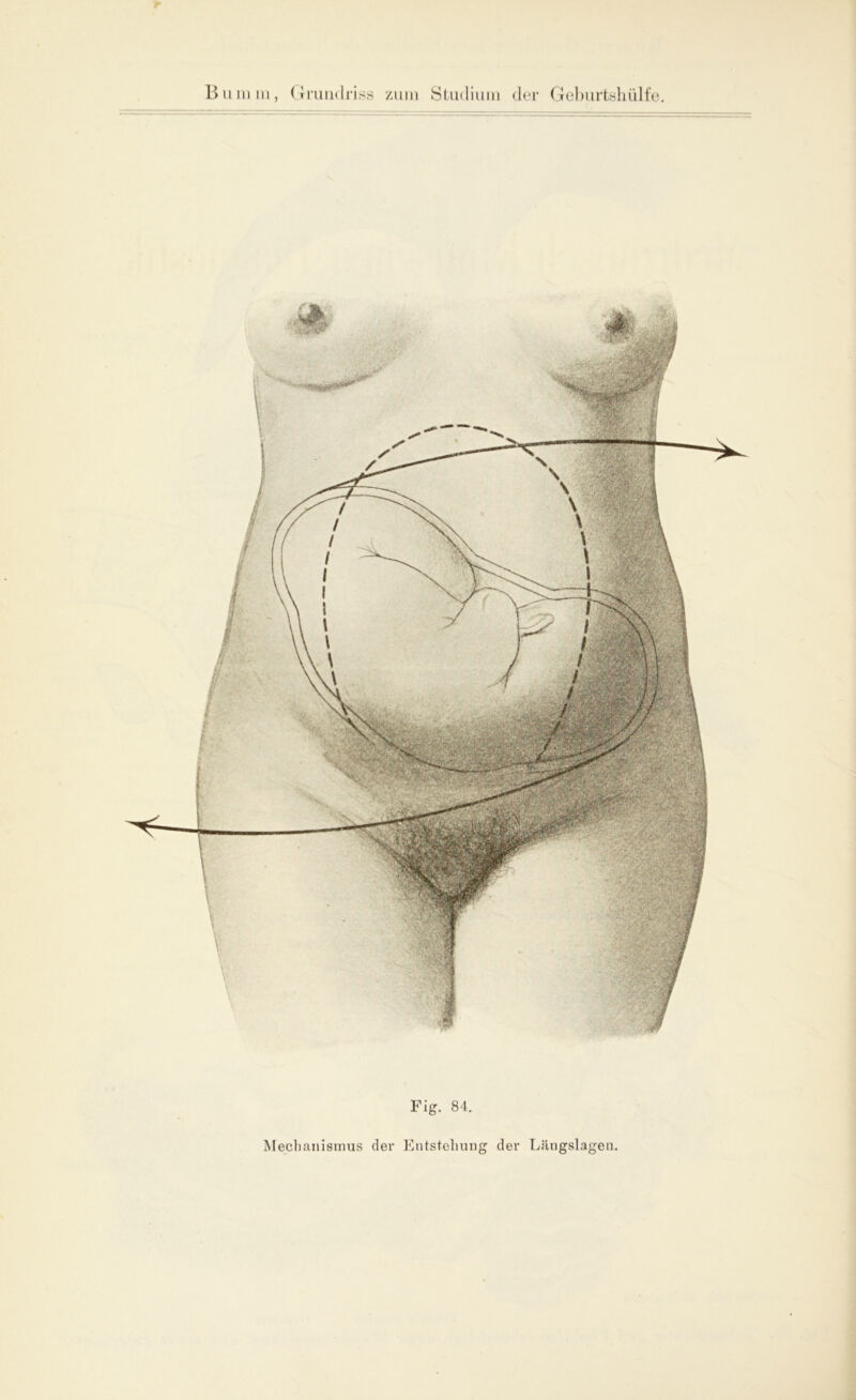 Fig. 84. Mechanismus der Entstehung der Längslagen