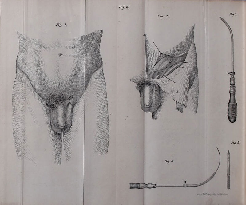 J'iy. 1. TaßJV Fig.3. Fig. 2. Fy.5.