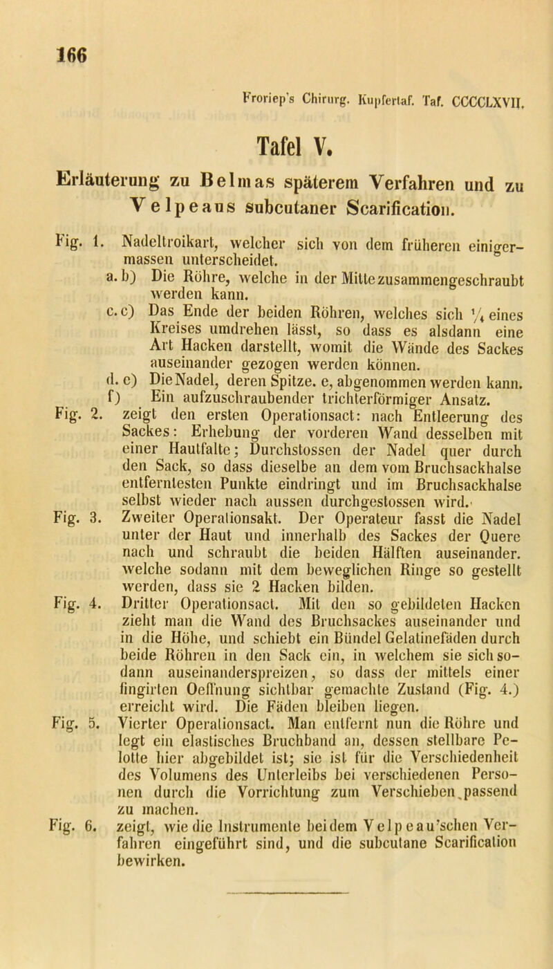 Froriep's Chirurg. Kupfertaf. Taf. CCCCLXVII. Tafel V. Erläuterung zu Belinas späterem Verfahren und zu Velpeaus subcutaner Scarification. fig. 1. Nadeltroikarl, welcher sich yon dem früheren einio-er- massen unterscheidet. a. h) Die Rühre, welche in der Mitte zusammengeschraubt werden kann. c. c) Das Ende der beiden Röhren, welches sich % eines Kreises umdrehen lässt, so dass es alsdann eine Art Hacken darstellt, womit die Wände des Sackes auseinander gezogen werden können. d. c) Die Nadel, deren Spitze, e, abgenommen werden kann. f) Ein aufzuschraubender trichterförmiger Ansatz. Fig. 2. zeigt den ersten Operationsact: nach Entleerung des Sackes: Erhebung der vorderen Wand desselben mit einer Haulfaltc; Durehstossen der Nadel quer durch den Sack, so dass dieselbe an dem vom Bruchsackhalse entferntesten Punkte eindringt und im Bruchsackhalse selbst wieder nach aussen durchgestossen wird. Fig. 3. Zweiter Operalionsakt. Der Operateur fasst die Nadel unter der Haut und innerhalb des Sackes der Quere nach und schraubt die beiden Hälften auseinander, welche sodann mit dem beweglichen Ringe so gestellt werden, dass sie 2 Hacken bilden. Fig. 4. Dritter Operalionsact. Mit den so gebildeten Hacken zieht man die Wand des Bruchsackes auseinander und in die Höhe, und schiebt ein Bündel Gelatinefäden durch beide Röhren in den Sack ein, in welchem sie sich so- dann auseinanderspreizen, so dass der mittels einer fingirten Oefi'nung sichtbar gemachte Zustand (Fig. 4.) erreicht wird. Die Fäden bleiben liegen. Fig. 5. Vierter Operalionsact. Man entfernt nun die Röhre und legt ein elastisches Bruchband an, dessen stellbare Pe- lotte hier abgebildet ist; sie ist für die Verschiedenheit des Volumens des Unterleibs bei verschiedenen Perso- nen durch die Vorrichtung zum Verschieben,passend zu machen. Fig. 6. zeigt, wie die Instrumente bei dem Velp eau’schen Ver- fahren eingeführt sind, und die subcutane Scarification bewirken.