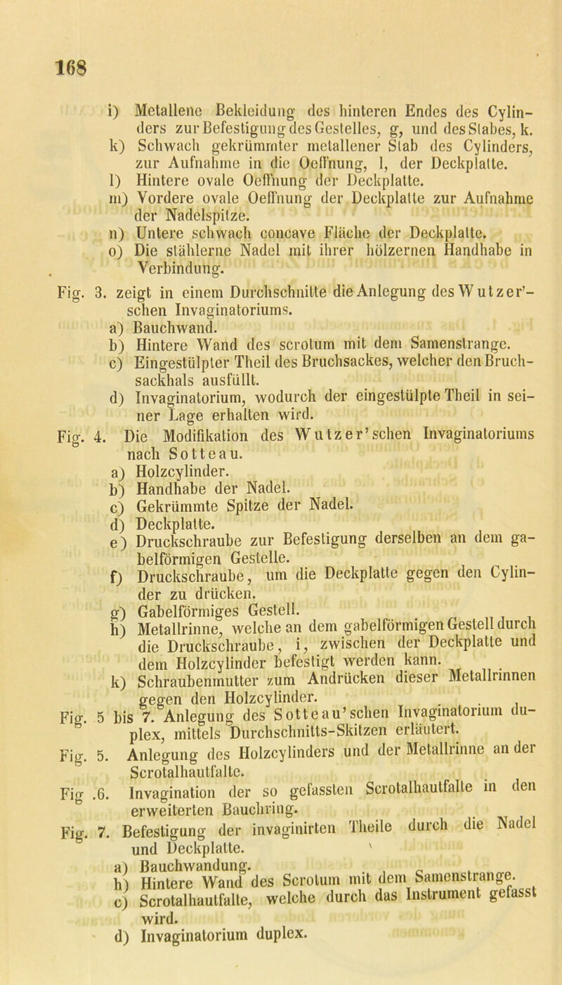 i) Metallene Bekleidung- des hinteren Endes des Cylin- ders zur Befestigung des Gestelles, g, und des Stabes, k. k) Schwach gekrümmter metallener Stab des Cylinders, zur Aufnahme in die Oclfnung, 1, der Deckplatte. l) Hintere ovale Oeffnung der Deckplatte. in) Vordere ovale Oeffnung der Deckplatte zur Aufnahme der Nadelspitze. n) Untere schwach concave Fläche der Deckplatte. o) Die stählerne Nadel mit ihrer hölzernen Handhabe in Verbindung. Fig. 3. zeigt in einem Durchschnitte die Anlegung des Wutzer’- schen Invaginatoriums. a) Bauchwand. b) Hintere Wand des scrolum mit dem Samenslrangc. c) Eingestülpter Theil des Bruchsackes, welcher den Bruch- sackhals ausfüllt. d) Invaginatorium, wodurch der eingestülpte Theil in sei- ner Lage erhalten wird. Fig. 4. Die Modifikation des Wutz er’sehen Invaginatoriums nach Sotteau. a) Holzcylinder. b) Handhabe der Nadel. c) Gekrümmte Spitze der Nadel. d) Deckplatte. e) Druckschraube zur Befestigung derselben an dem ga- belförmigen Gestelle. f) Druckschraube, um die Deckplatte gegen den Cylin- der zu drücken. g) Gabelförmiges Gestell. h) Metallrinne, welche an dem gabelförmigen Gestell durch die Druckschraube, i, zwischen der Deckplatte und dem Holzcylinder befestigt werden kann. k) Schraubenmutter zum Andrücken dieser Metallrinnen gegen den Holzcylinder. Fig. 5 bis 7. Anlegung des Sotteau’sehen Invaginatorium du- plex, mittels Durchschnitts-Skitzen erläutert. Fig. 5. Anlegung des Holzcylinders und der Metalliinne an dei Scrotalhautfalte. Fig .6. Invagination der so gefassten Scrotalhautfalte in den erweiterten Bauchring. Fig. 7. Befestigung der invaginirten Tlieile durch die Nadel und Deckplatte. ' a) Bauchwandung. . , _ . h) Hintere Wand des Scrolum mit dem Samenstrange. c) Scrotalhautfalte, welche durch das Instrument gefasst wird. d) Invaginatorium duplex.