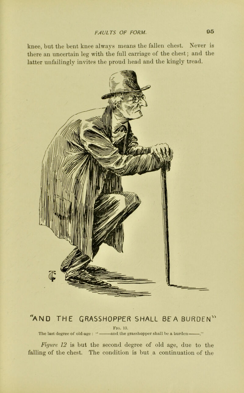 knee, but the bent knee always means the fallen chest. Never is there an uncertain leg with the full carriage of the chest; and the latter unfailingly invites the proud head and the kingly tread. AND THE GRASSHOPPER SHALL BEA BURDEN” Fig. 13. The last degree of old-age : “ and the grasshopper shall he a burden Figure 12 is but the second degree of old age, due to the falling of the chest. The condition is but a continuation of the