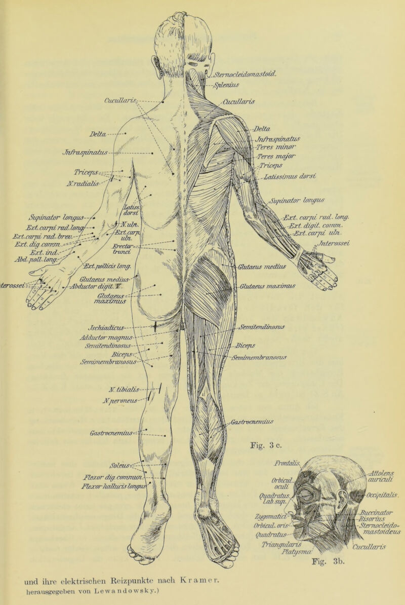 iS'temocleido7Tiastoia7. -Splenius Ciu'uIl/iriS; Delta- ■ Tnfraxpinatu, Triceps^y. sY.radialw - Supinator longus—/<- { Ext.carpirad.lonah^EjEvla. Ext.carpi md. breu.--rJiS?^, '*/ uffe\i Ext. di/j. eomm,. -=~ / jzrectar=-- Ext. incL'''j-J‘ / / trunci Abd.jwll. Ion ff.\s j /'Ext.fwIUcuf lonff. Lerosset =; -Abductor diffit. -Delta Fn/hwpituntus -Teres minor -Teres ma/or ,.:Tricefis -Latissimus dorsi ■Supinator lonffun ■Ext. rar/u reut. lang. ■Ext. diffit. cornm. carpi uin. ^Jnterossei Flexor dfff.corrmxnX--\--% Fk-xorludtwis longiA * \-Sl/o/ens ,, - 'Jfl UMLC-nc» mttCr-auriculi Ocapitalis. ^i-Bu/xinator -Bworin,s Sterrwcleido- mastoideus Cundlarw Fig. 3b. und ihre elektrischen Reizpunkte nach Kramer. herausgegeben von Lewa ndowsky.)