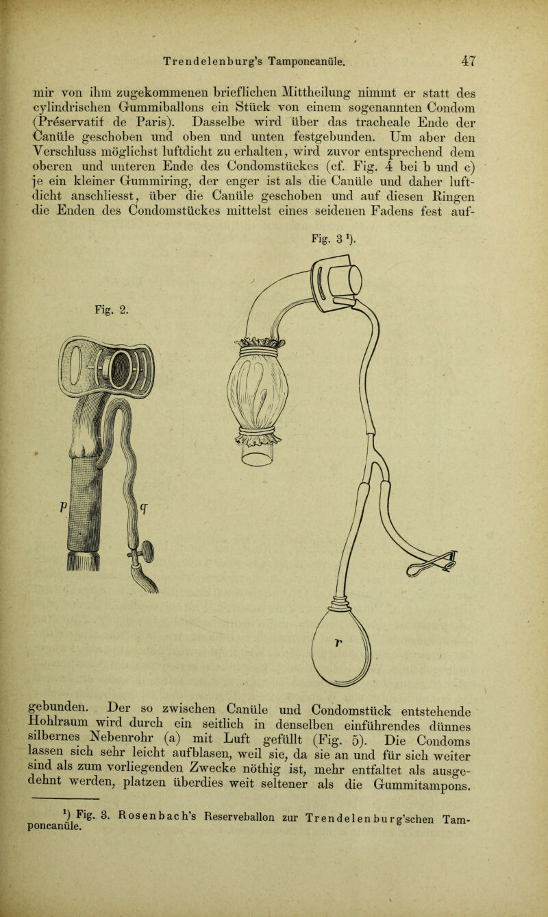 mir von ihm zugekommenen brieflichen Mittheilung nimmt er statt des cylindrischen Gummiballons ein Stück von einem sogenannten Condom (Pröservatif de Paris). Dasselbe wird über das tracheale Ende der Canüle geschoben und oben und unten festgebunden. Um aber den Verschluss möglichst luftdicht zu erhalten; wird zuvor entsprechend dem oberen und unteren Ende des Condomstückes (cf. Fig. 4 bei b und c) je ein kleiner Gummiring, der enger ist als die Canüle und daher luft- dicht anschliesst, über die Canüle geschoben und auf diesen Ringen die Enden des Condomstückes mittelst eines seidenen Fadens fest auf- Fig. 2. Fig. 3 *). gebunden. Der so zwischen Canüle und Condomstück entstehende Hohlraum wird durch ein seitlich in denselben einführendes dünnes silbernes Nebenrohr (a) mit Luft gefüllt (Fig. 5). Die Condoms lassen sich sehr leicht auf blasen, weil sie, da sie an und für sich weiter sind als zum vorliegenden Zwecke nöthig ist, mehr entfaltet als ausge- dehnt werden, platzen überdies weit seltener als die Gummitampons. ) Fig. 3. Rosenbachs Reserveballon zur Trendelenburg’schen Tam- poncanule.