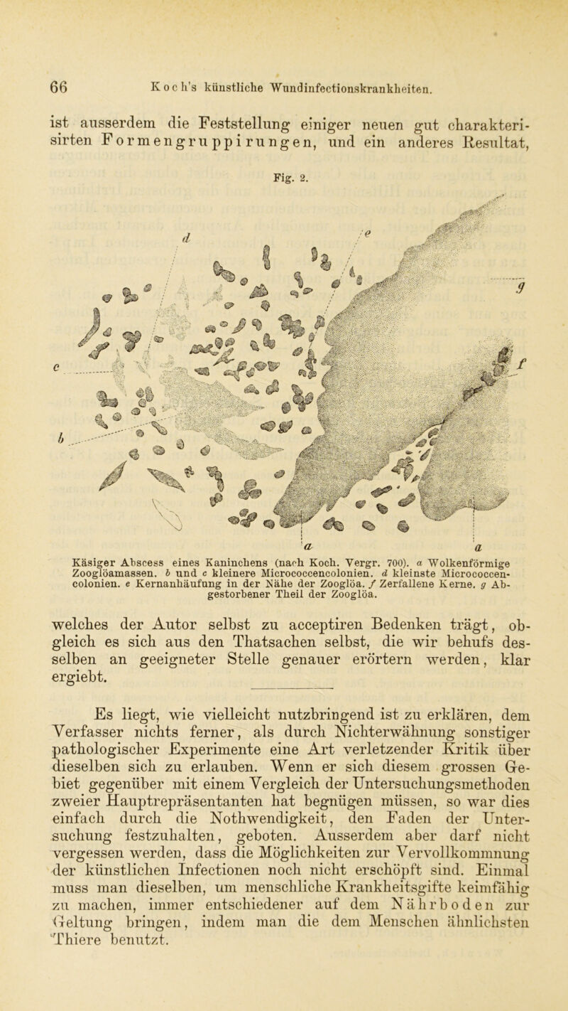 ist ausserdem die Feststellung einiger neuen gut charakteri- sirten Formengruppirungen, und ein anderes Resultat, Fig. 2. Käsiger Abseess eines Kaninchens (nach Koch. Vergr. 700). a Wolkenformige Zooglöamassen. b und c kleinere Micrococcencolonien. d kleinste Micrococcen- colonien. e Kernanhäufnng in der Nähe der Zooglöa. / Zerfallene Kerne, g Ab- gestorbener Theil der Zooglöa. welches der Autor selbst zu acceptiren Bedenken trägt, ob- gleich es sich aus den Thatsacben selbst, die wir behufs des- selben an geeigneter Stelle genauer erörtern werden, klar ergiebt. Fs liegt, wie vielleicht nutzbringend ist zu erklären, dem Verfasser nichts ferner, als durch Nichterwähnung sonstiger pathologischer Experimente eine Art verletzender Kritik über dieselben sich zu erlauben. Wenn er sich diesem grossen Ge- biet gegenüber mit einem Vergleich der Untersuchungsmethoden zweier Hauptrepräsentanten hat begnügen müssen, so war dies einfach durch die Nothwendigkeit , den Faden der Unter- suchung festzuhalten, geboten. Ausserdem aber darf nicht vergessen werden, dass die Möglichkeiten zur Vervollkommnung der künstlichen Infectionen noch nicht erschöpft sind. Einmal muss man dieselben, um menschliche Krankheitsgifte keimfähig zu machen, immer entschiedener auf dem Nährboden zur Geltung bringen, indem man die dem Menschen ähnlichsten fhiere benutzt.
